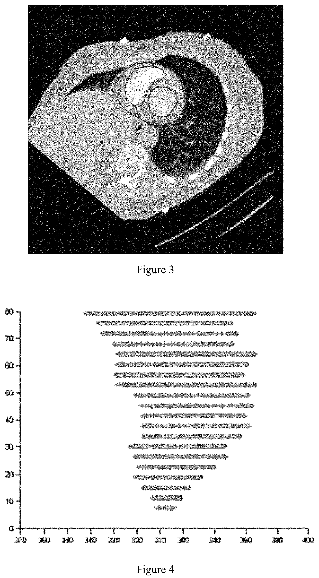 Method for noninvasive imaging of cardiac electrophysiological based on low rank and sparse constraints