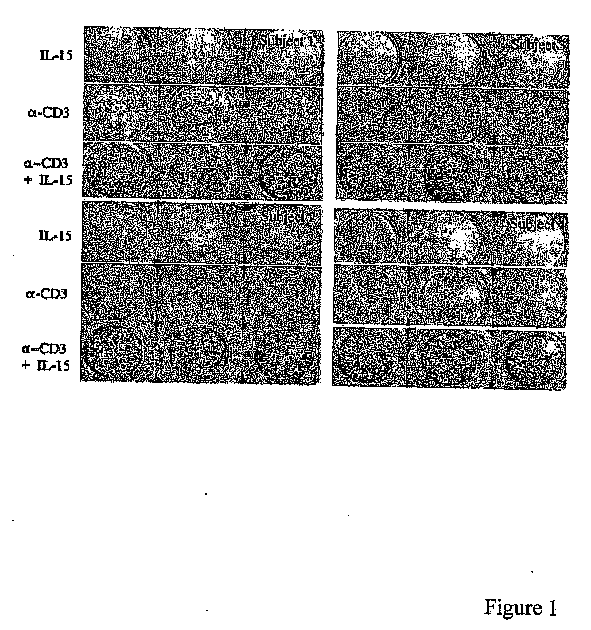 Nucleic acid sequences encoding and compositions comrpising ige signal peptide and/or il-15 and methods for using the same