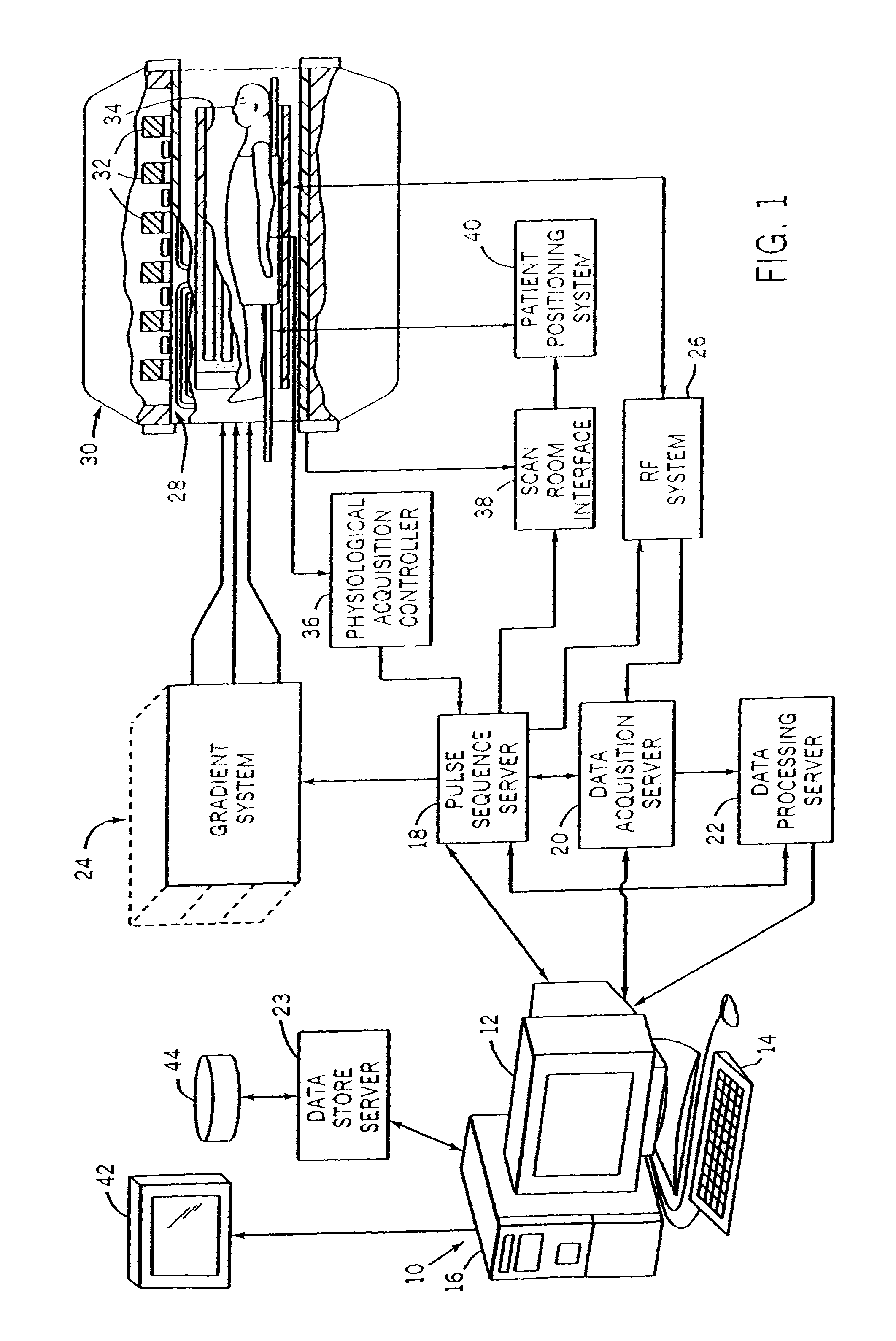 Accelerated shells trajectory MRI acquisition