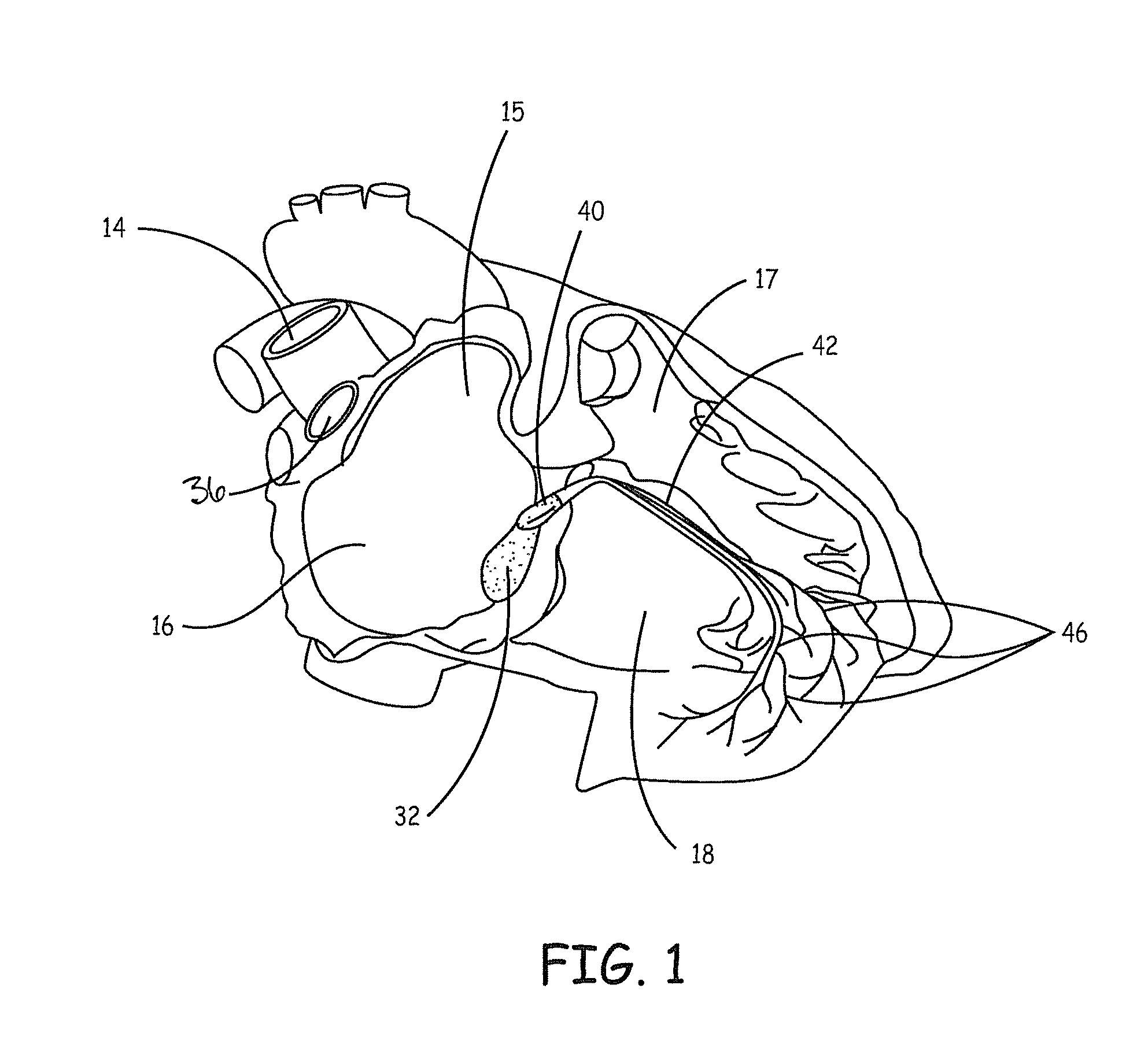 Biological pacemaker compositions and systems incorporating interstitial cells of cajal