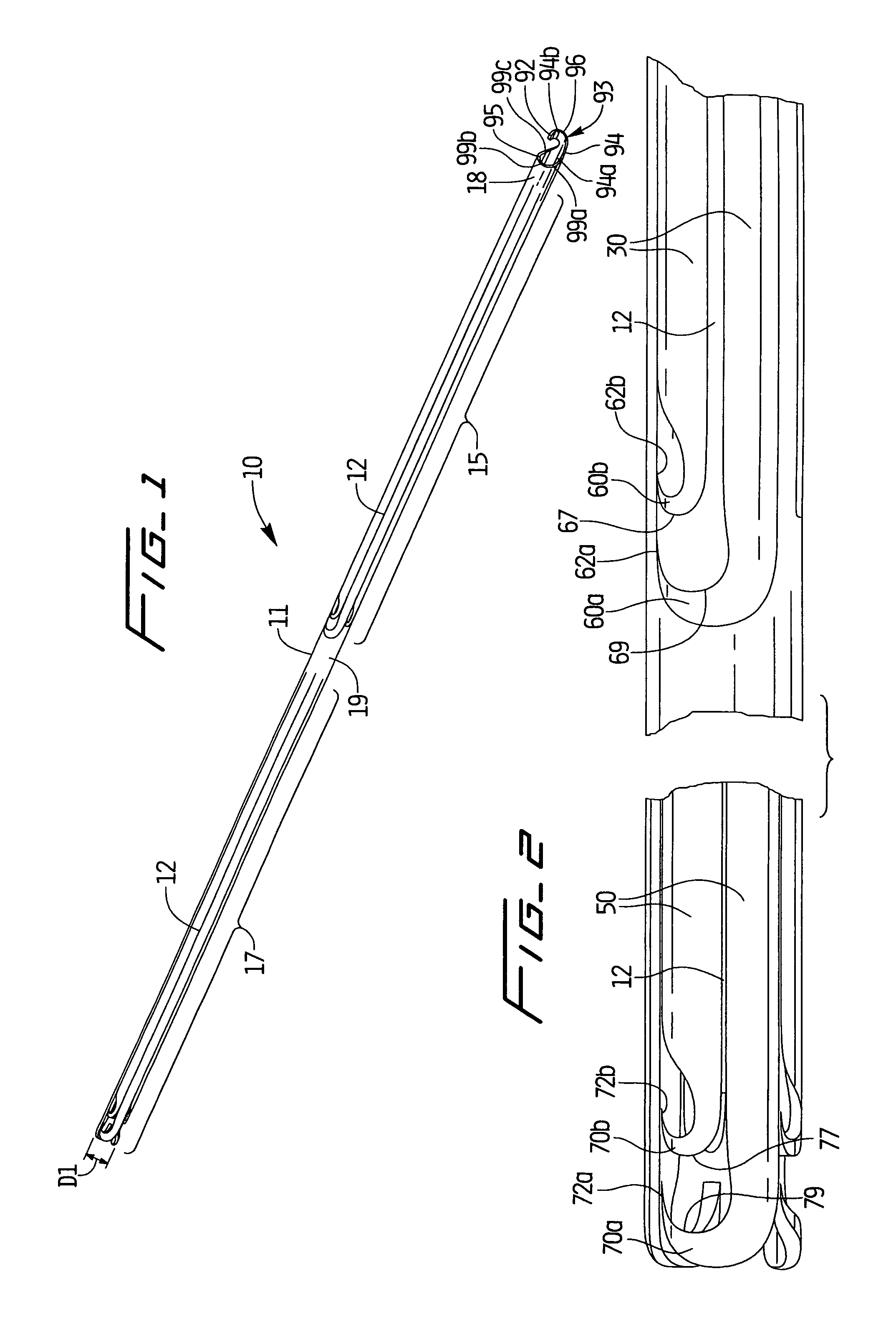 Vein filter