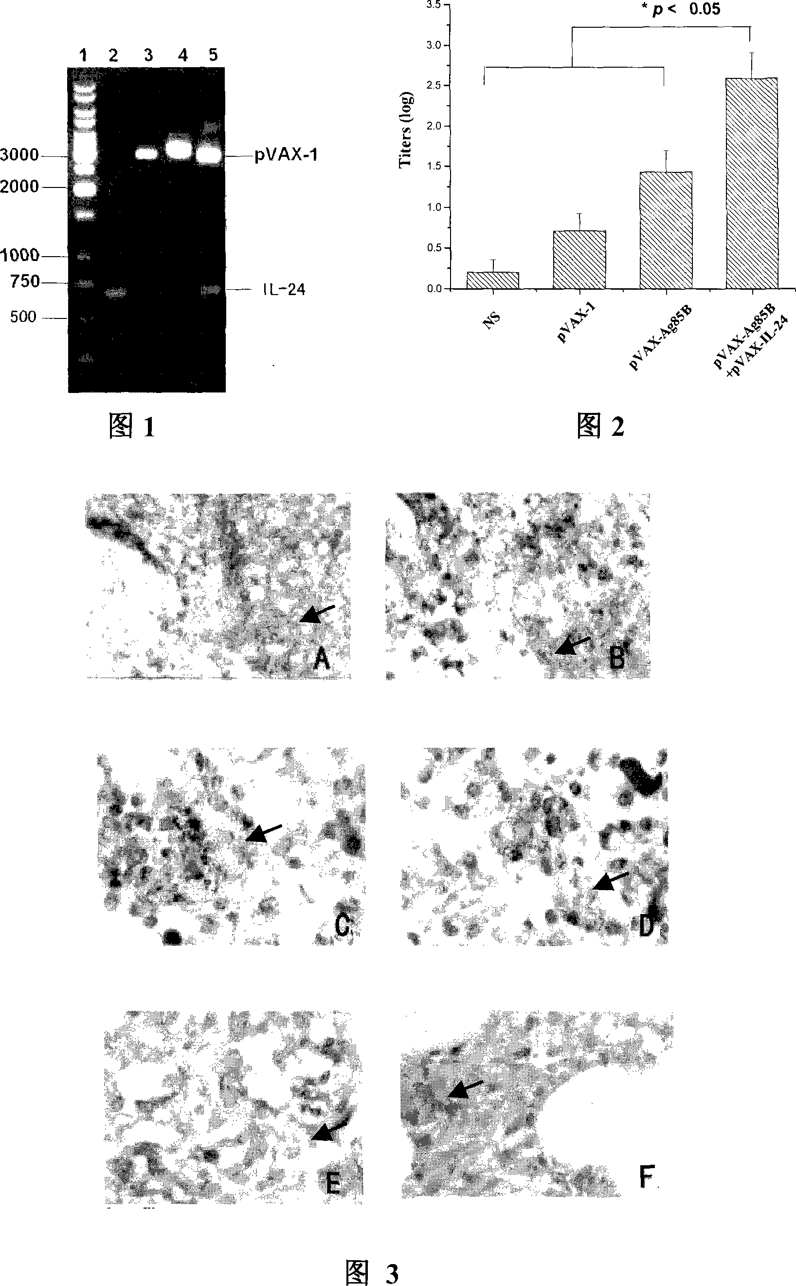 Intensified tubercle-resisting action of human interleukin 24