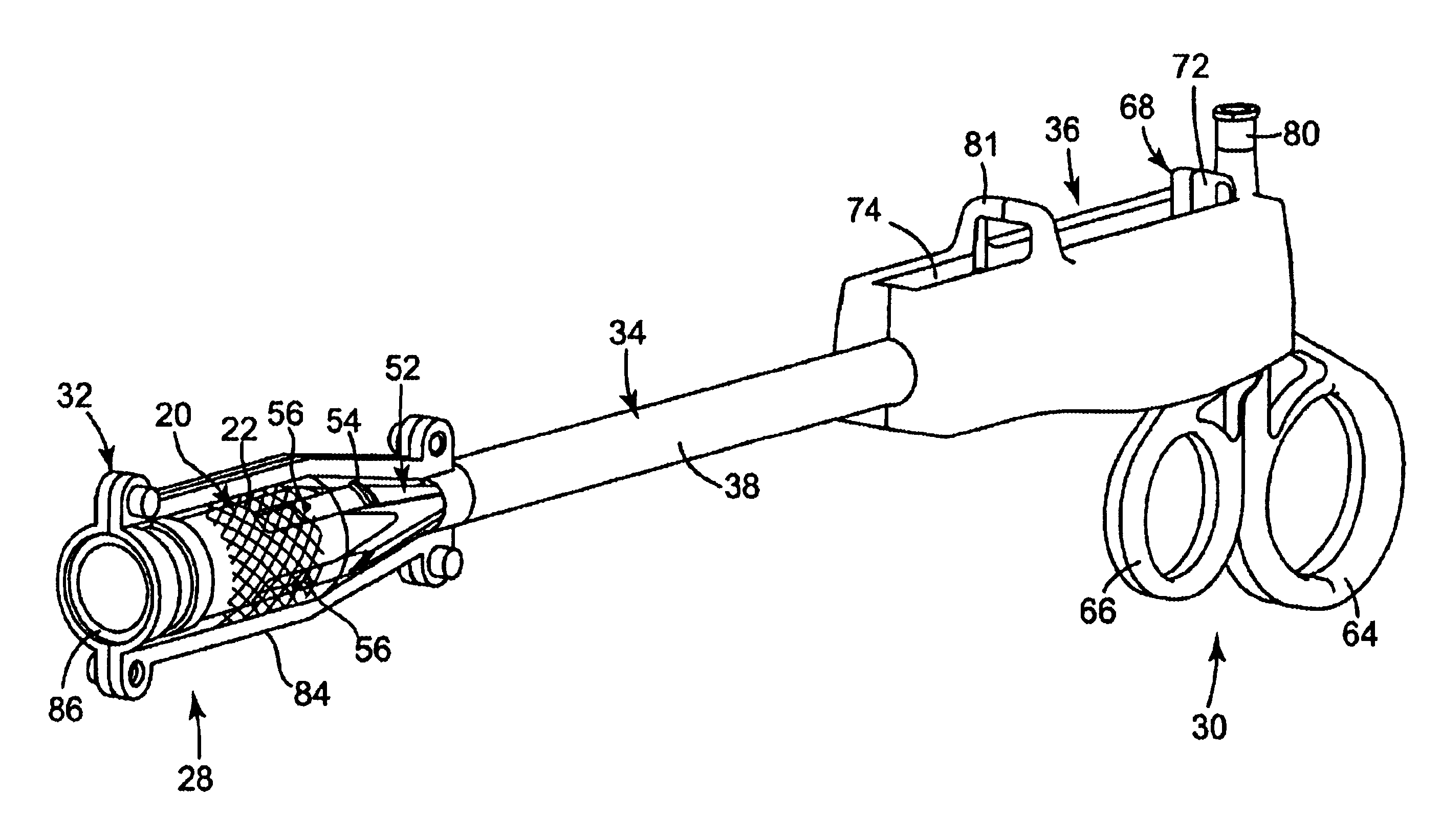 Stent delivery device and method