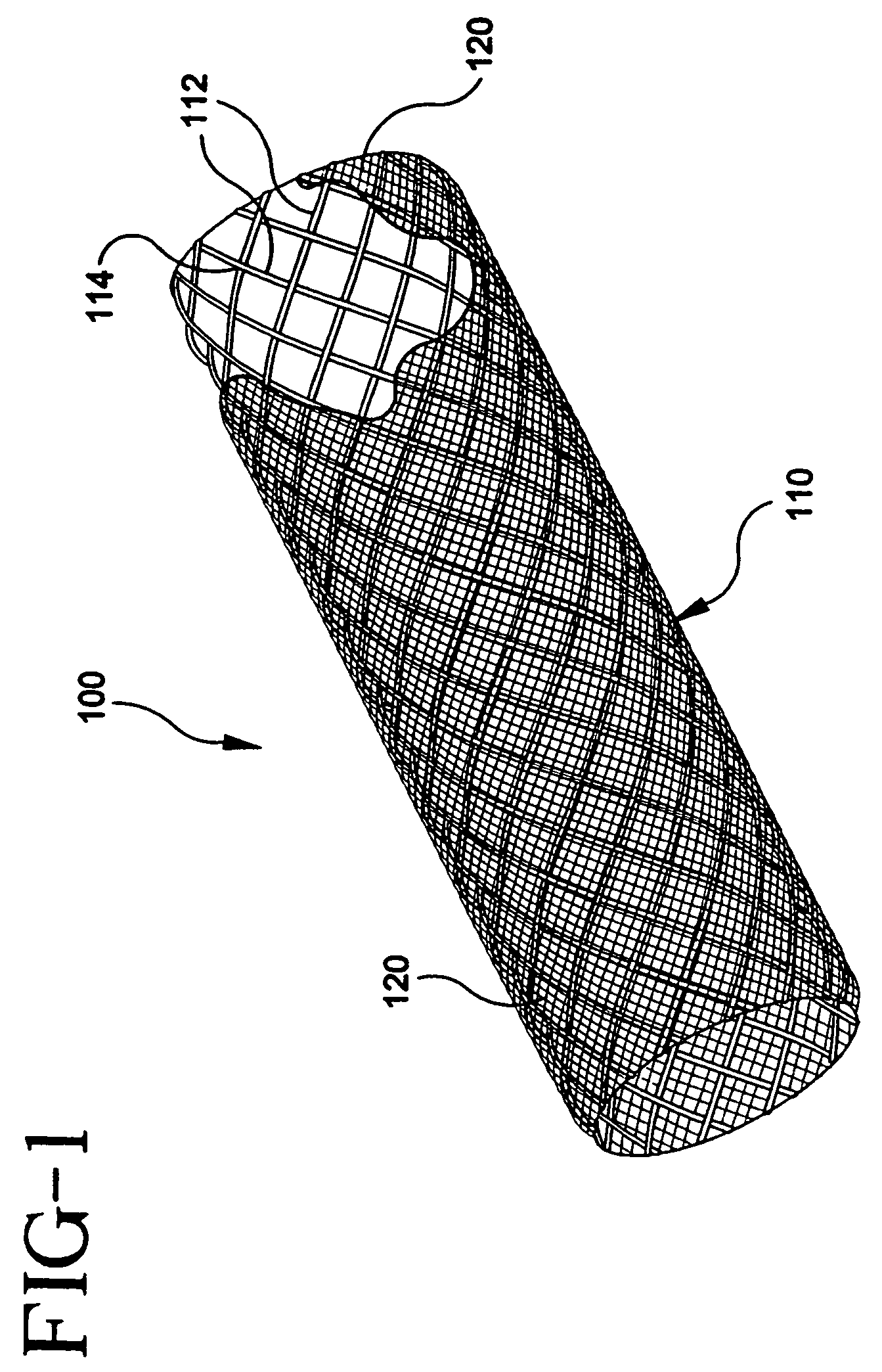 Stent-graft with bioabsorbable structural support