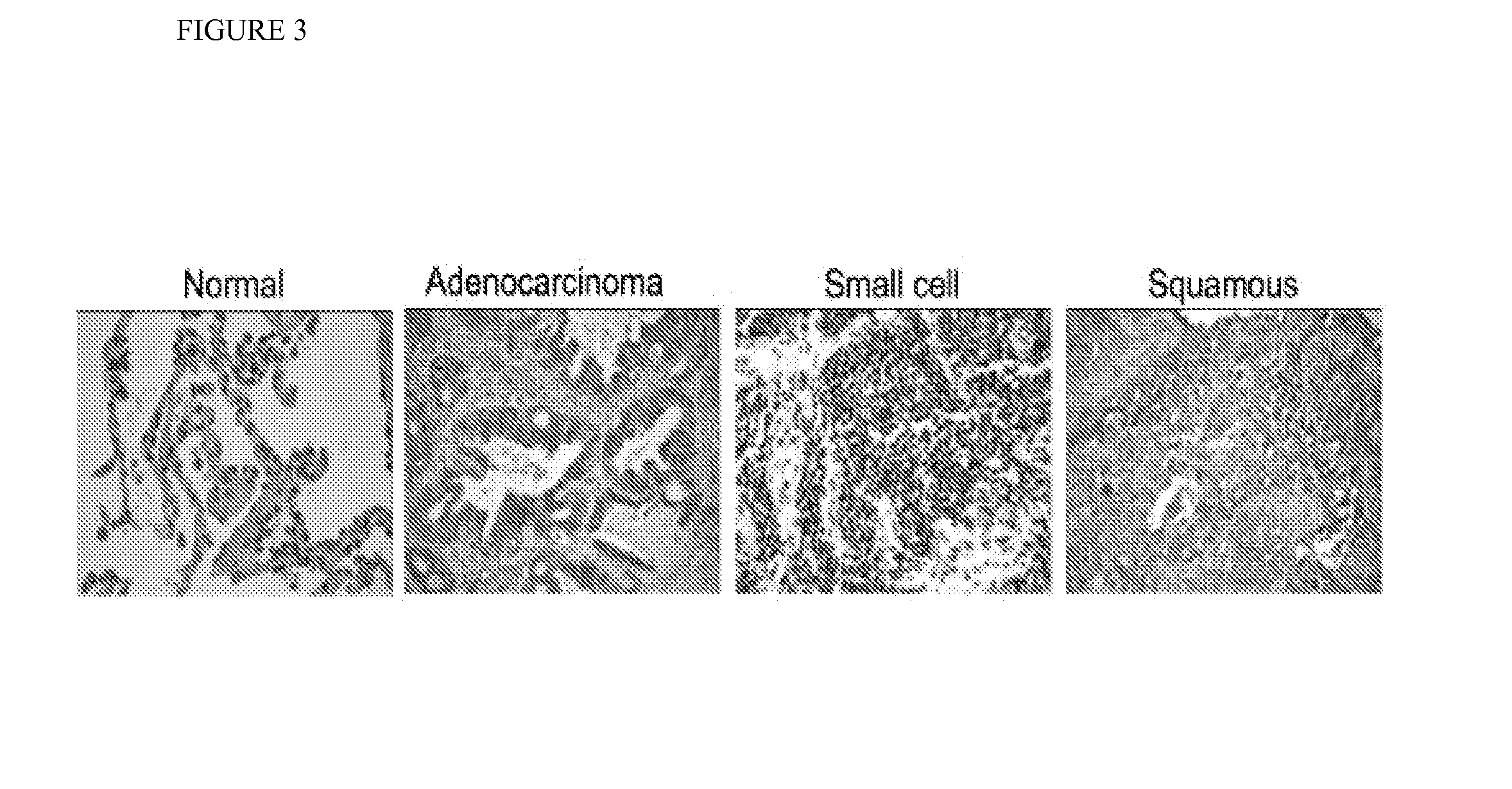 Compounds and methods of use in ablative radiotherapy