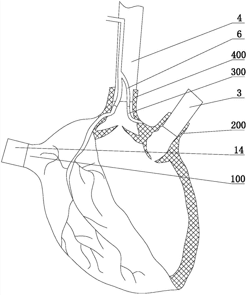 Double-channel perfusion experiment method and equipment for large animal isolated working heart