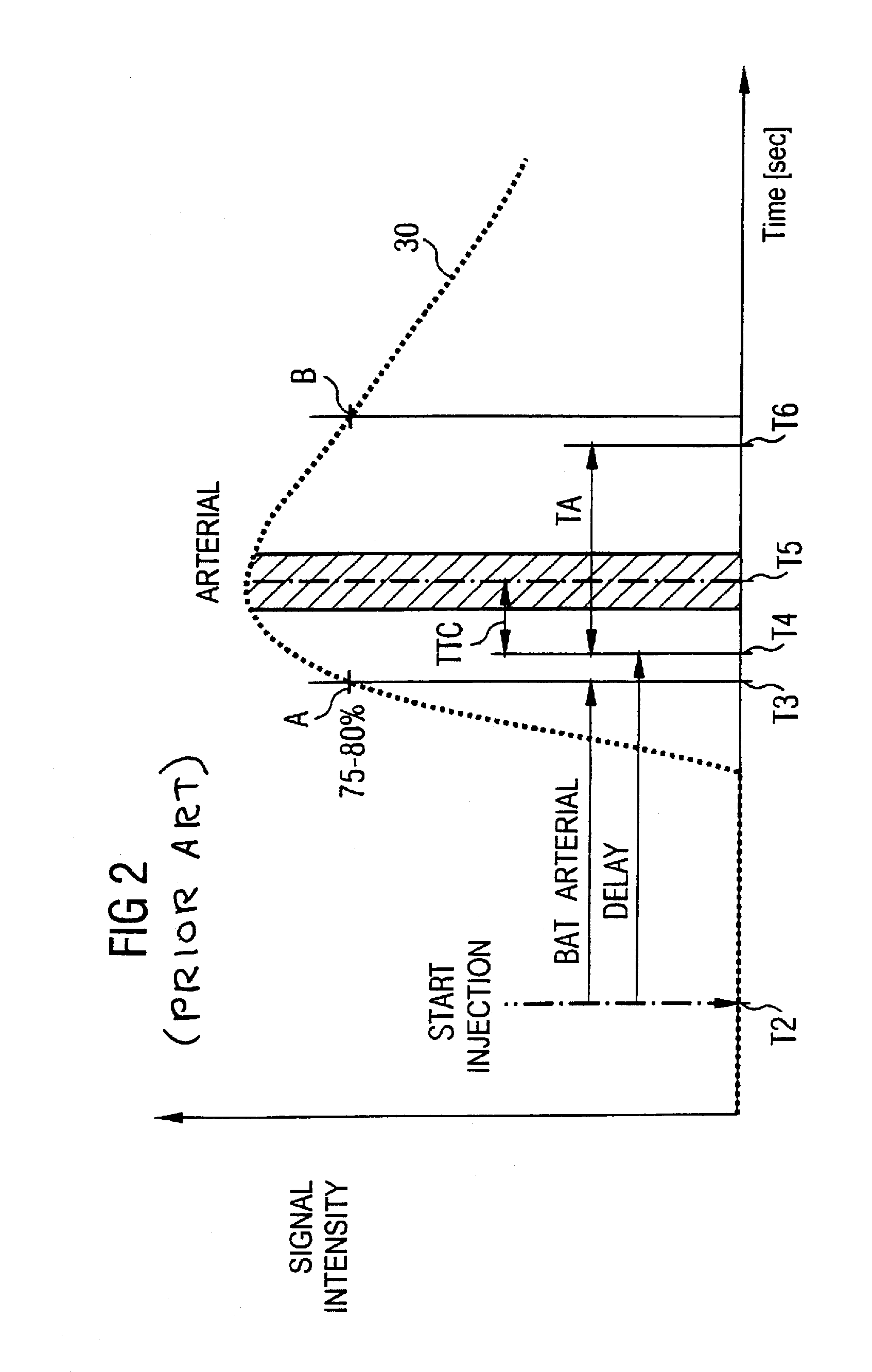 Method and magnetic resonance tomography apparatus for graphic planning of angiographic exposures using a contrast agent