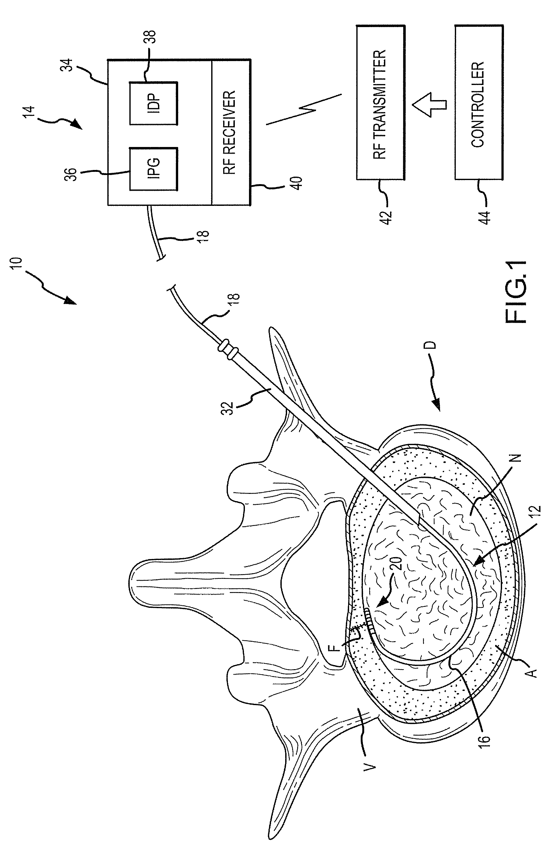 Combination electrical stimulating and infusion medical device and method