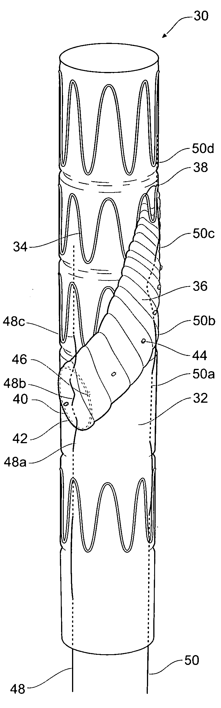 Helical arm tie down