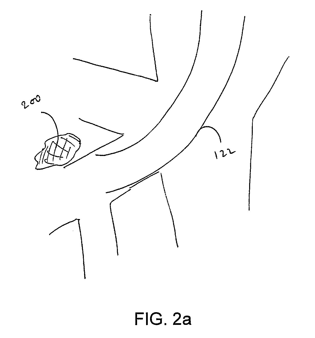 Methods for localized intra-body treatment of tissue