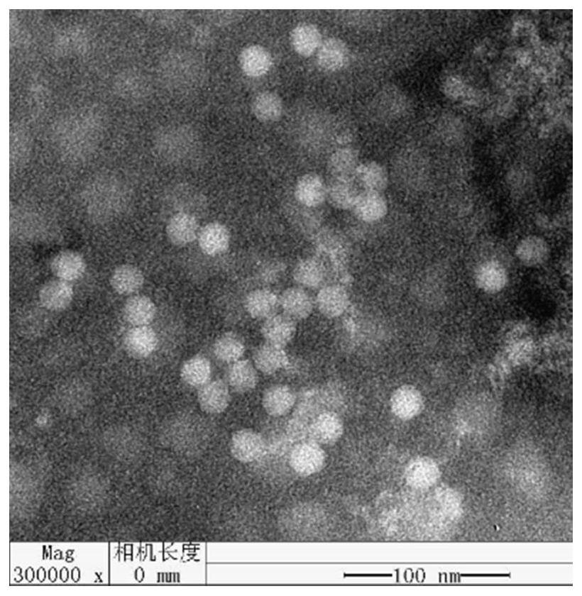 Seneca Valley Virus Strain and Its Application