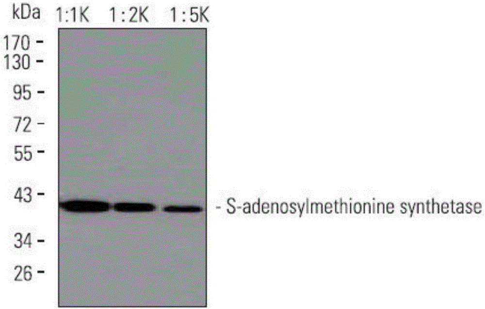 Monoclonal antibody of S-adenosyl methionine synthetase and application of such monoclonal antibody