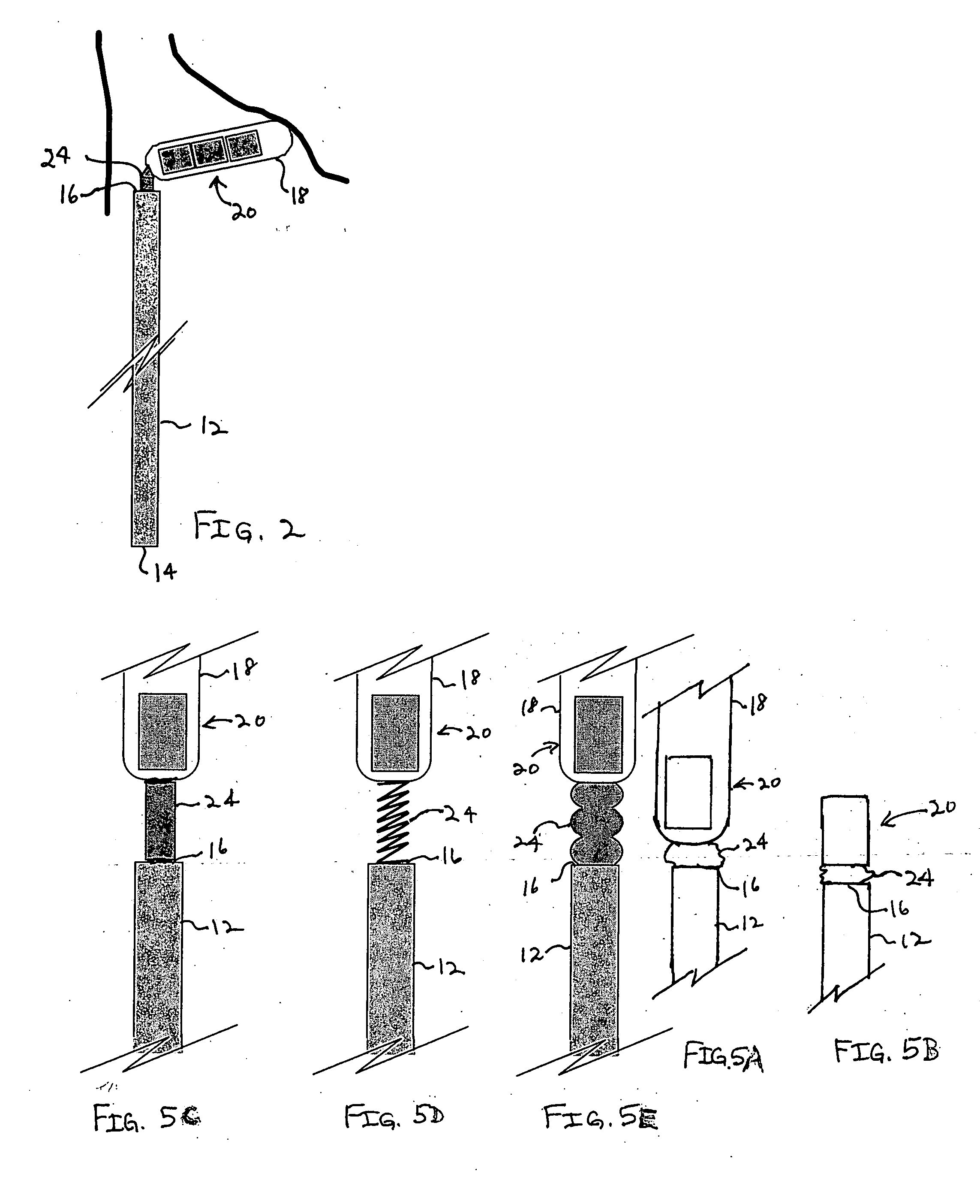 Method and apparatus for indicating an encountered obstacle during insertion of a medical device