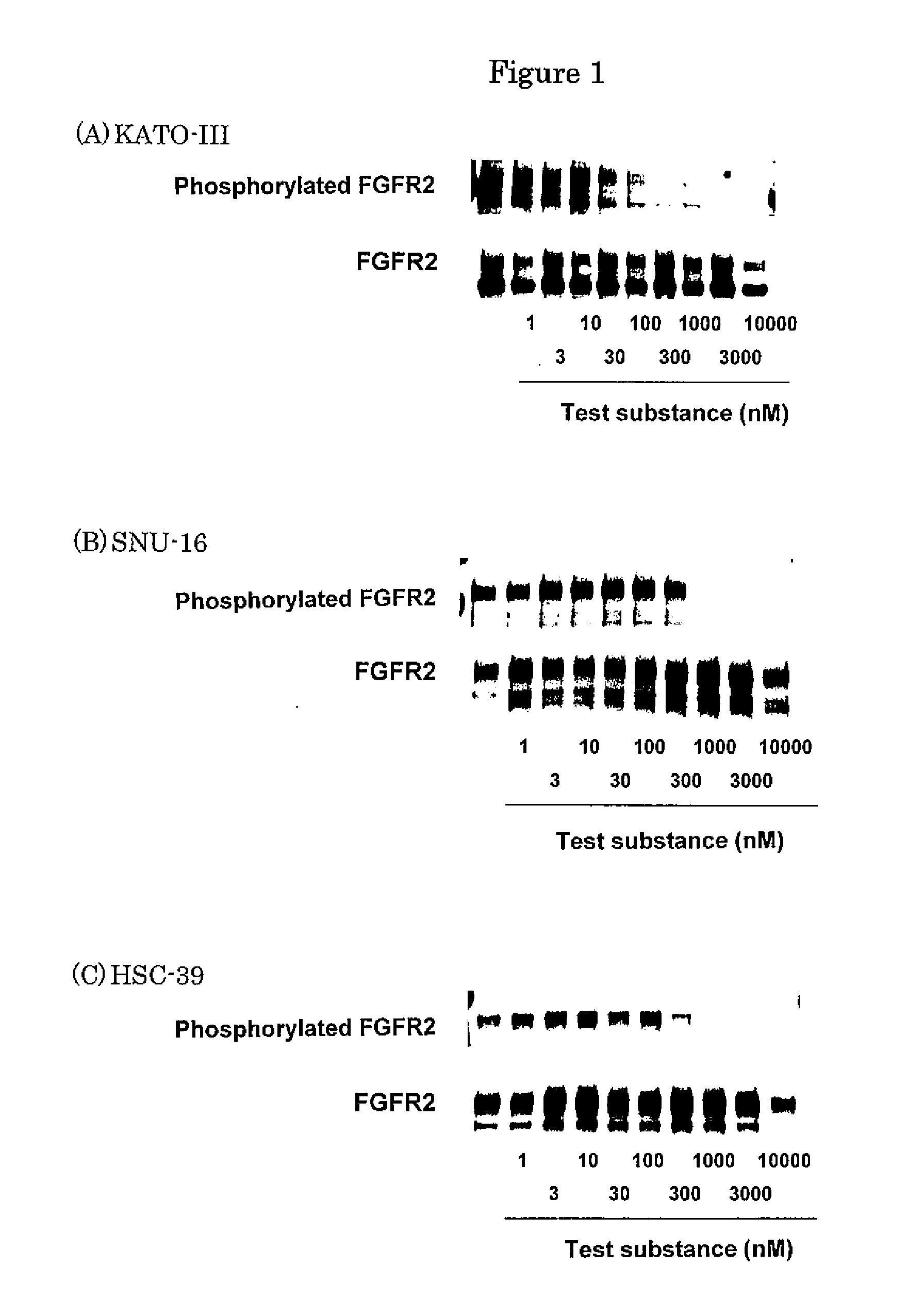 Antitumor agent for undifferentiated gastric cancer