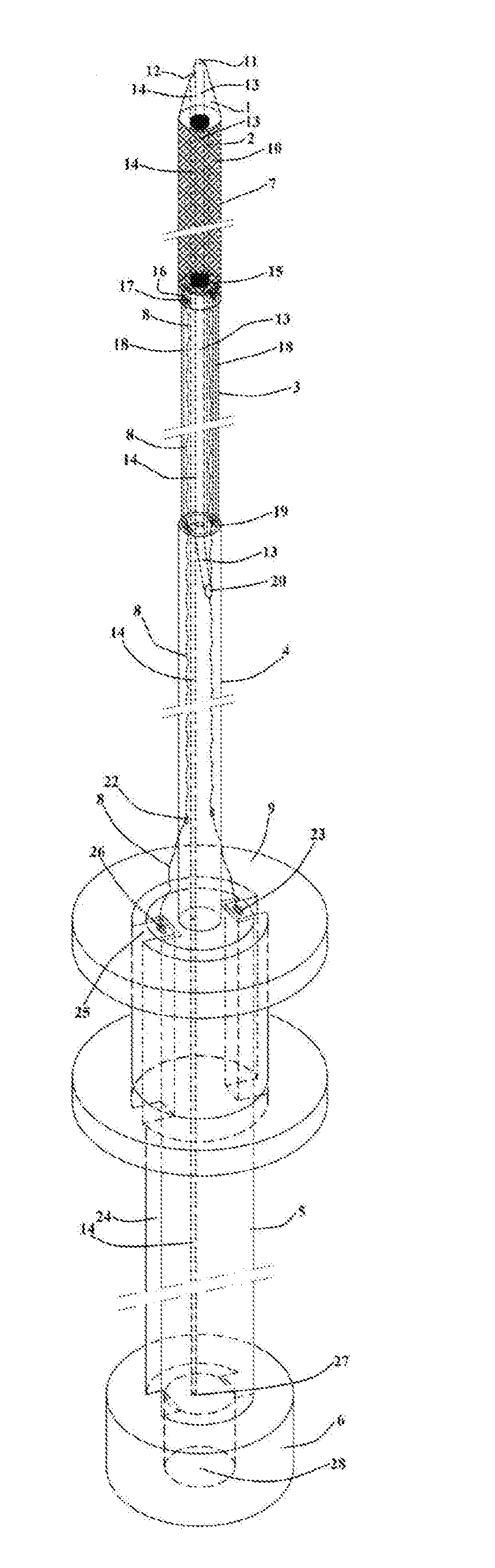 Short sheath delivery system for biliary metal stent via endoscope