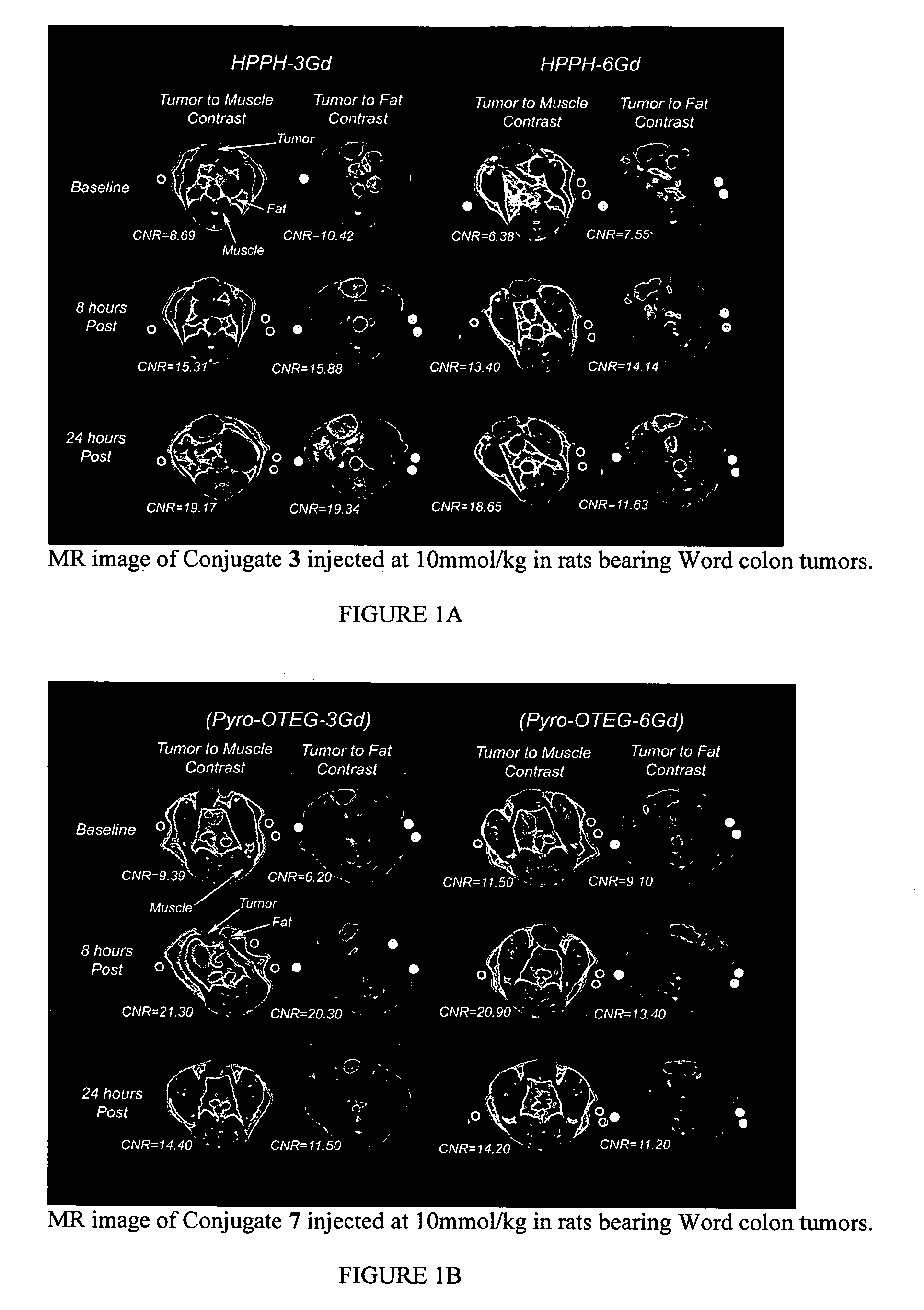 Multi DTPA conjugated tetrapyrollic compounds for phototherapeutic contrast agents