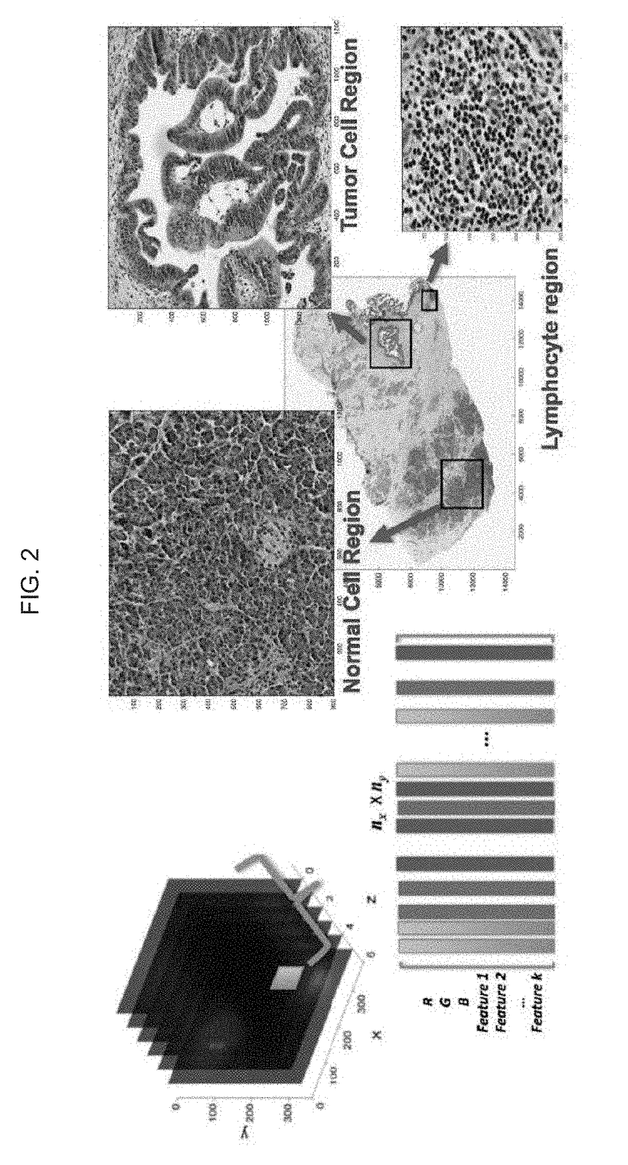 Automatic  nuclei segmentation in histopathology images