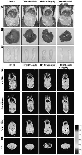 Roselle-Green Tea Composition for Amelioration of Diet-Induced Metabolic Disorders