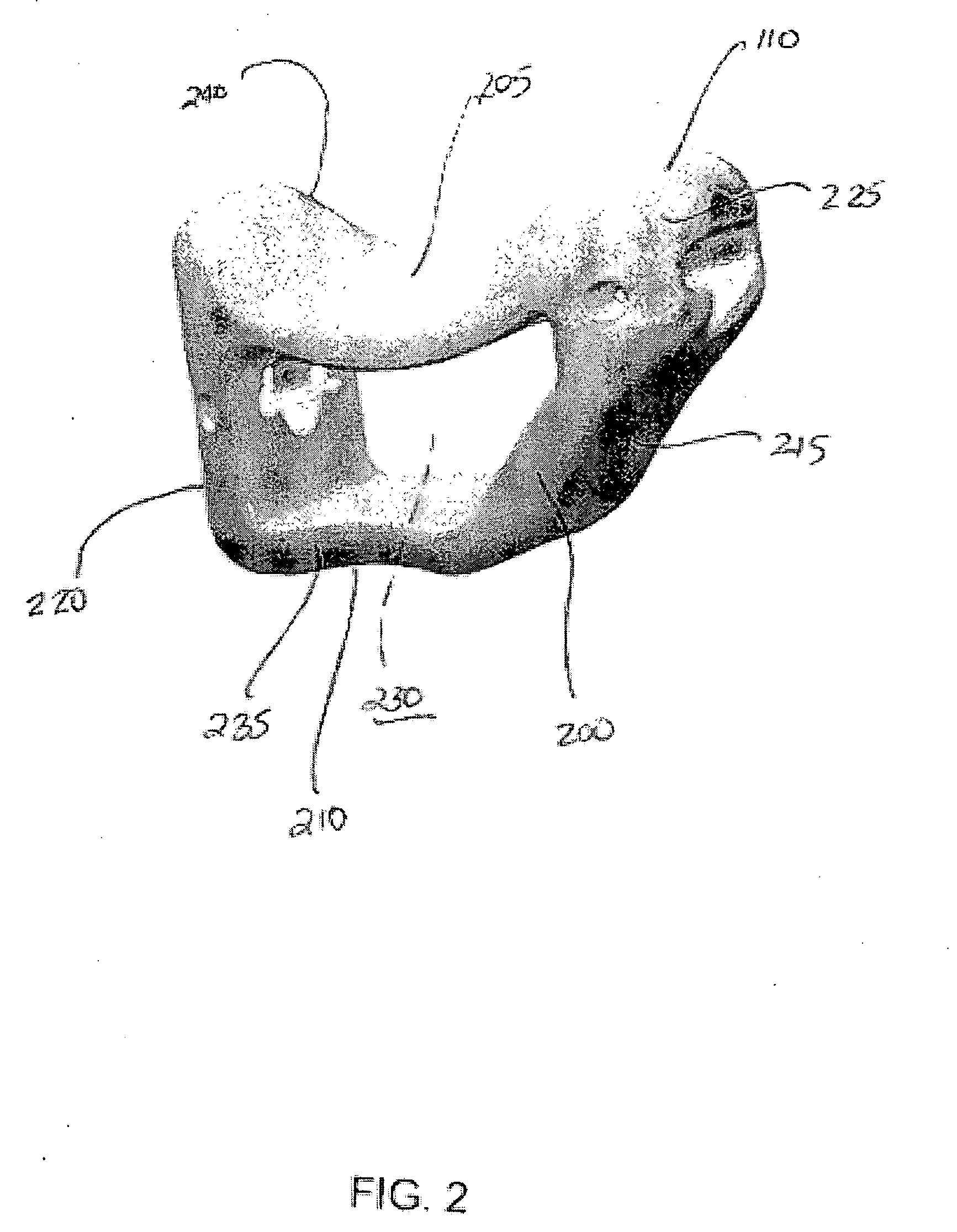 System and method for trapezium bone replacement