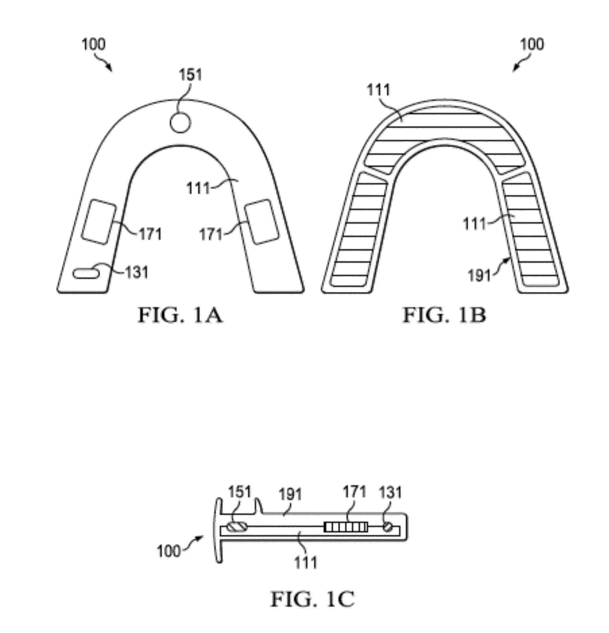 Intra-oral vibrating othodontic devices
