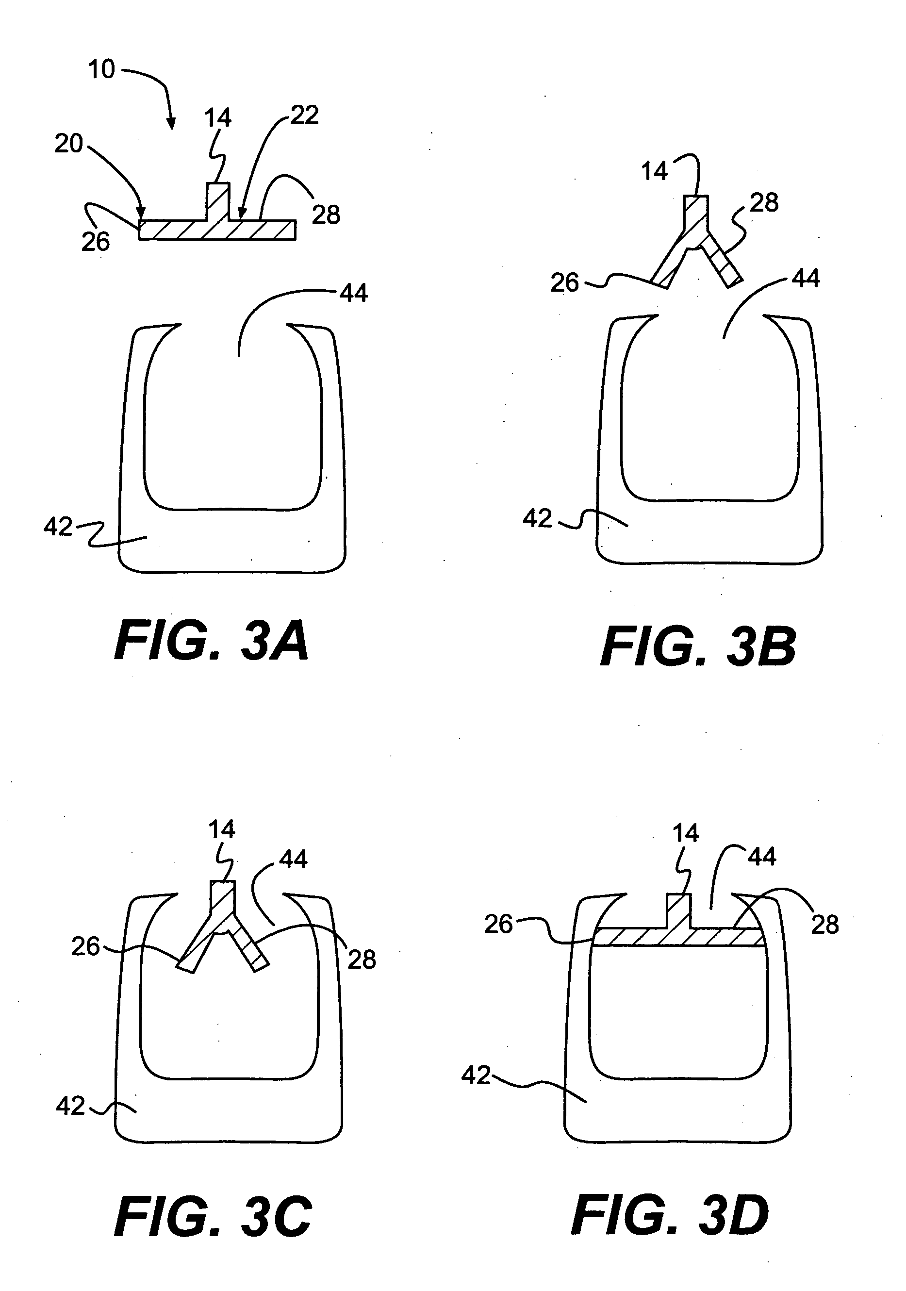 Method and apparatus for enhanced delivery of treatment device to the intervertebral disc annulus