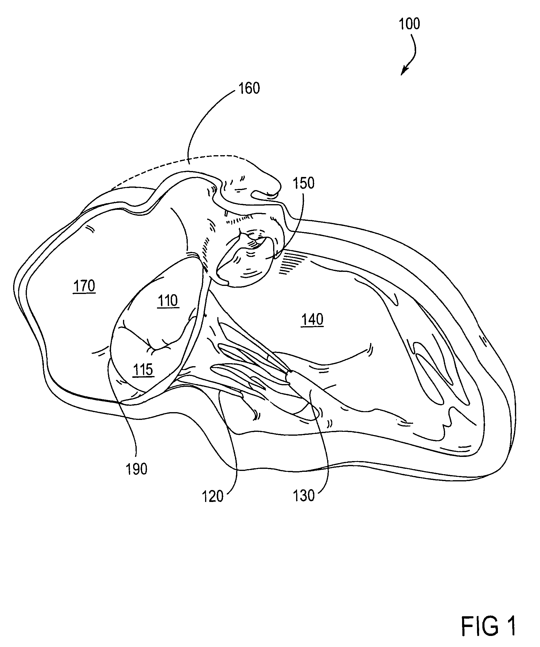 Methods and devices for heart valve treatments
