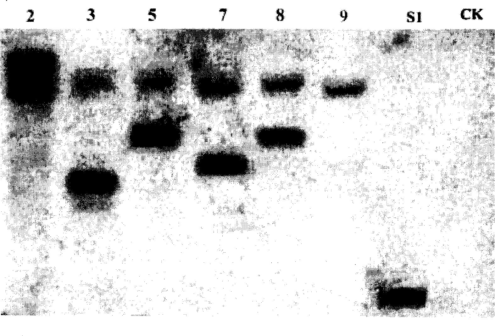 Production method of transgenic potato for expressing infectious bronchitis virus fibre mutein