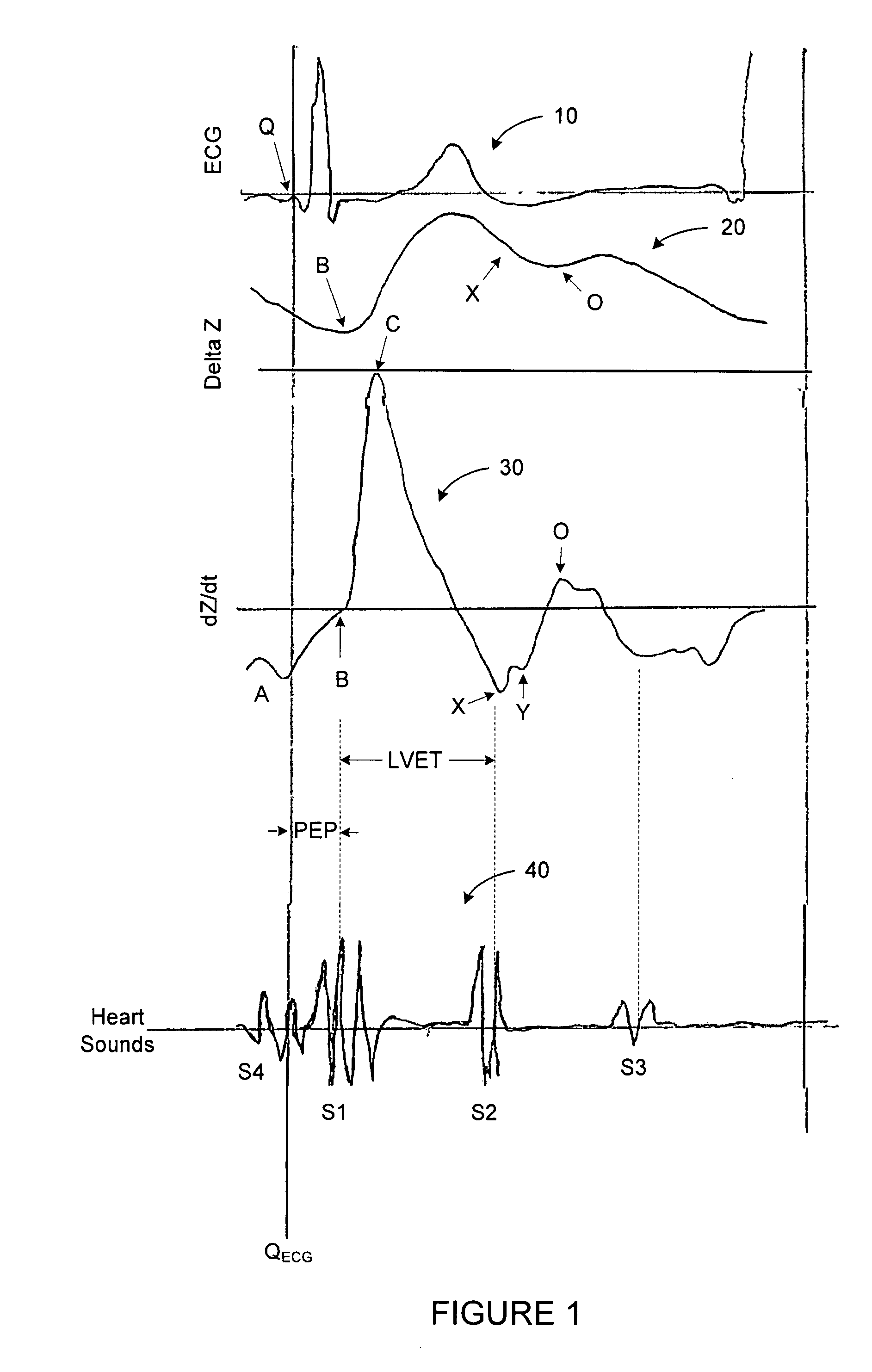 Estimating acute response to cardiac resynchronization therapy