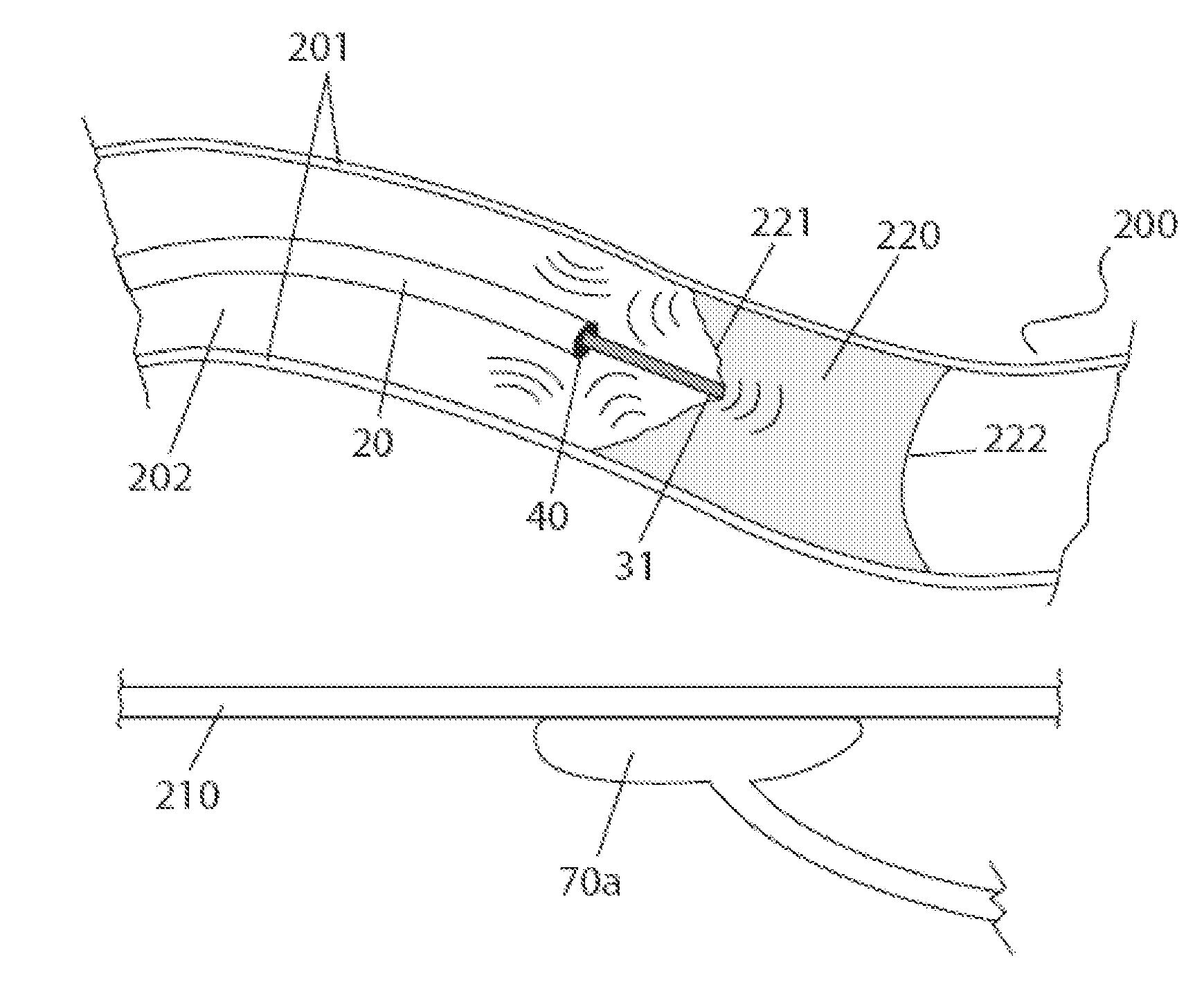 Apparatus and Method for Guided Chronic Total Occlusion Penetration
