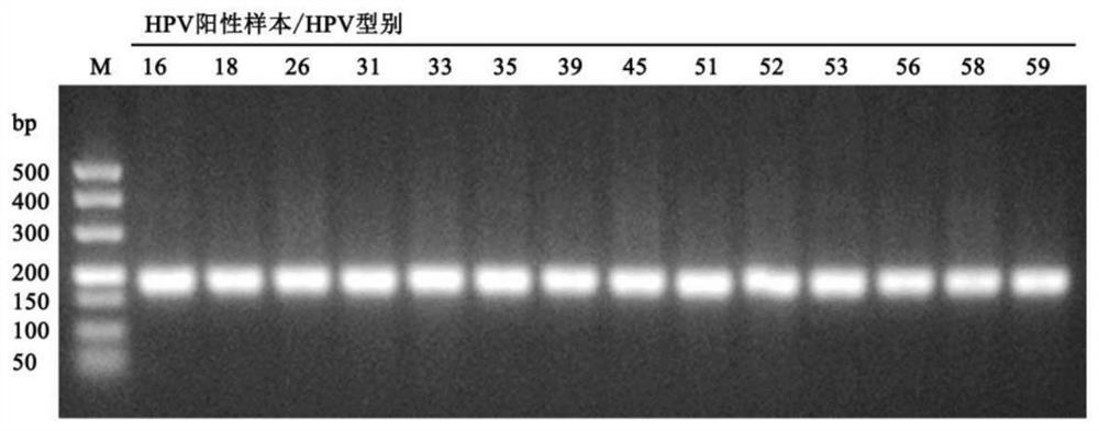 Primer and typing probe combination for detecting human papilloma virus and application of primer and typing probe combination