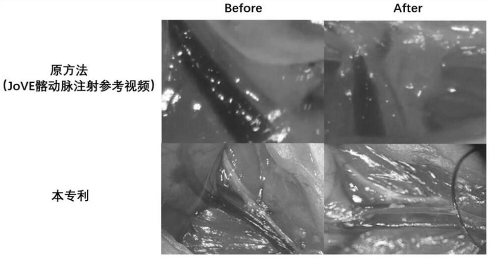 Novel breast cancer bone metastasis model making mode