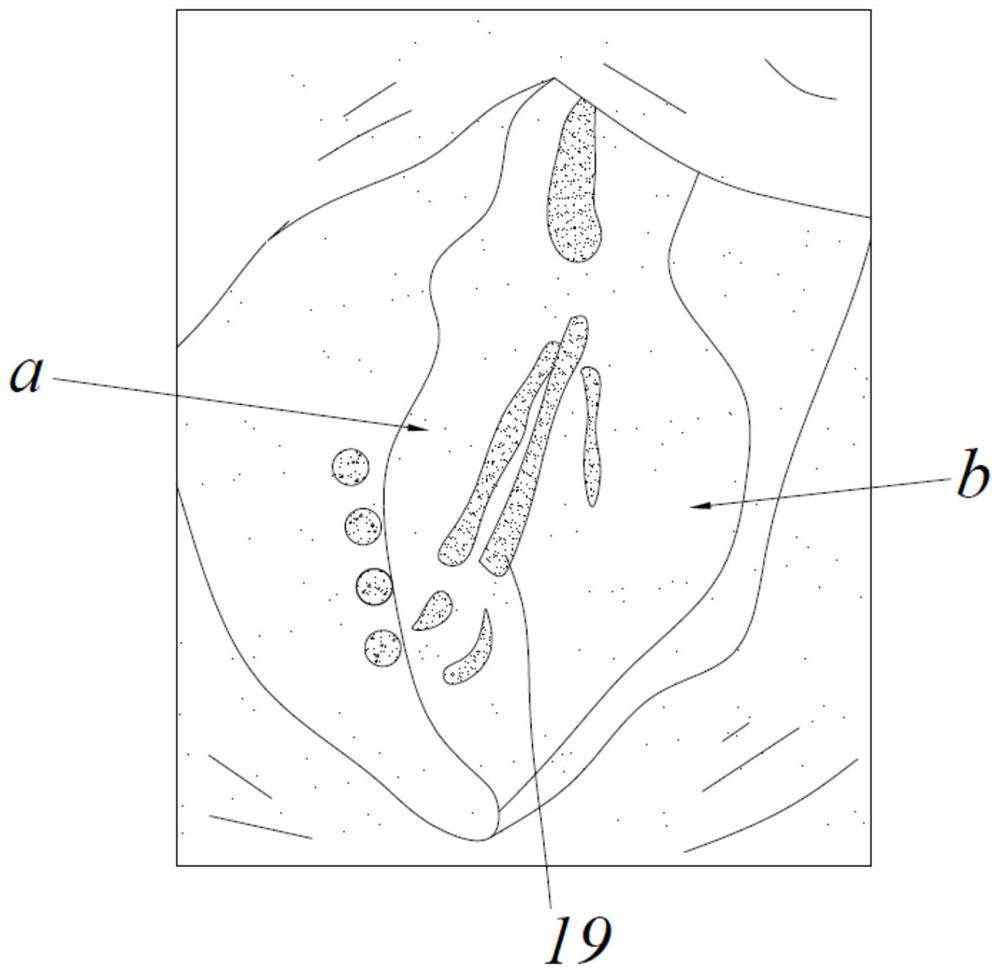 A spreading mechanism for orthopedic spine surgery tissue