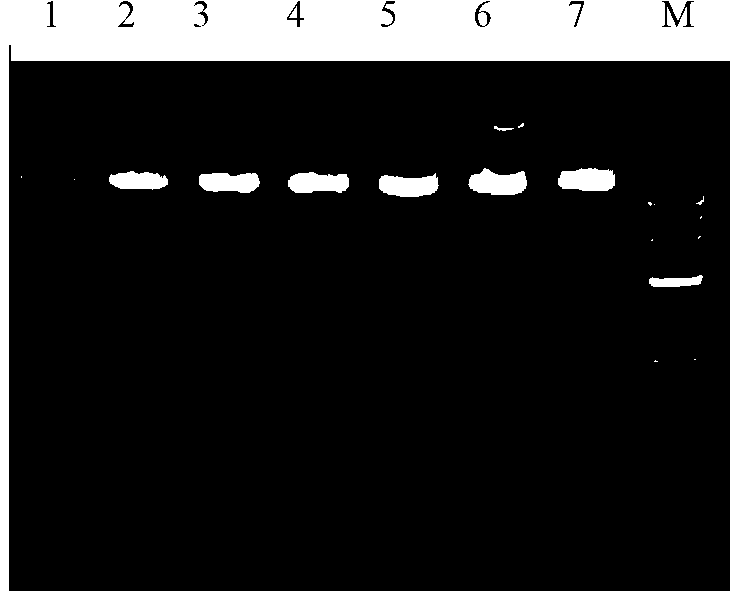 Melanoma therapeutic plasmid DNA (deoxyribonucleic acid) vaccine pSVK-CAVA preparation method as well as dedicated engineering bacterium and fermentation culture medium thereof