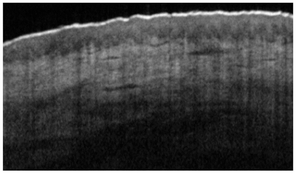 Automatic identification method of epidermal layers in skin optical coherence tomography images