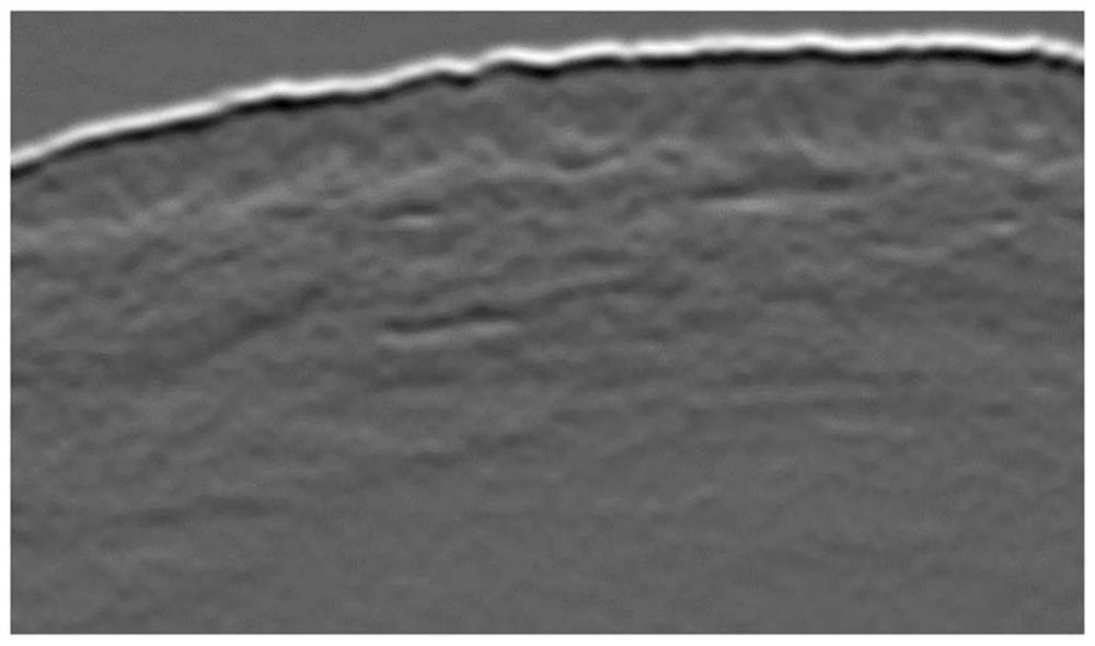 Automatic identification method of epidermal layers in skin optical coherence tomography images