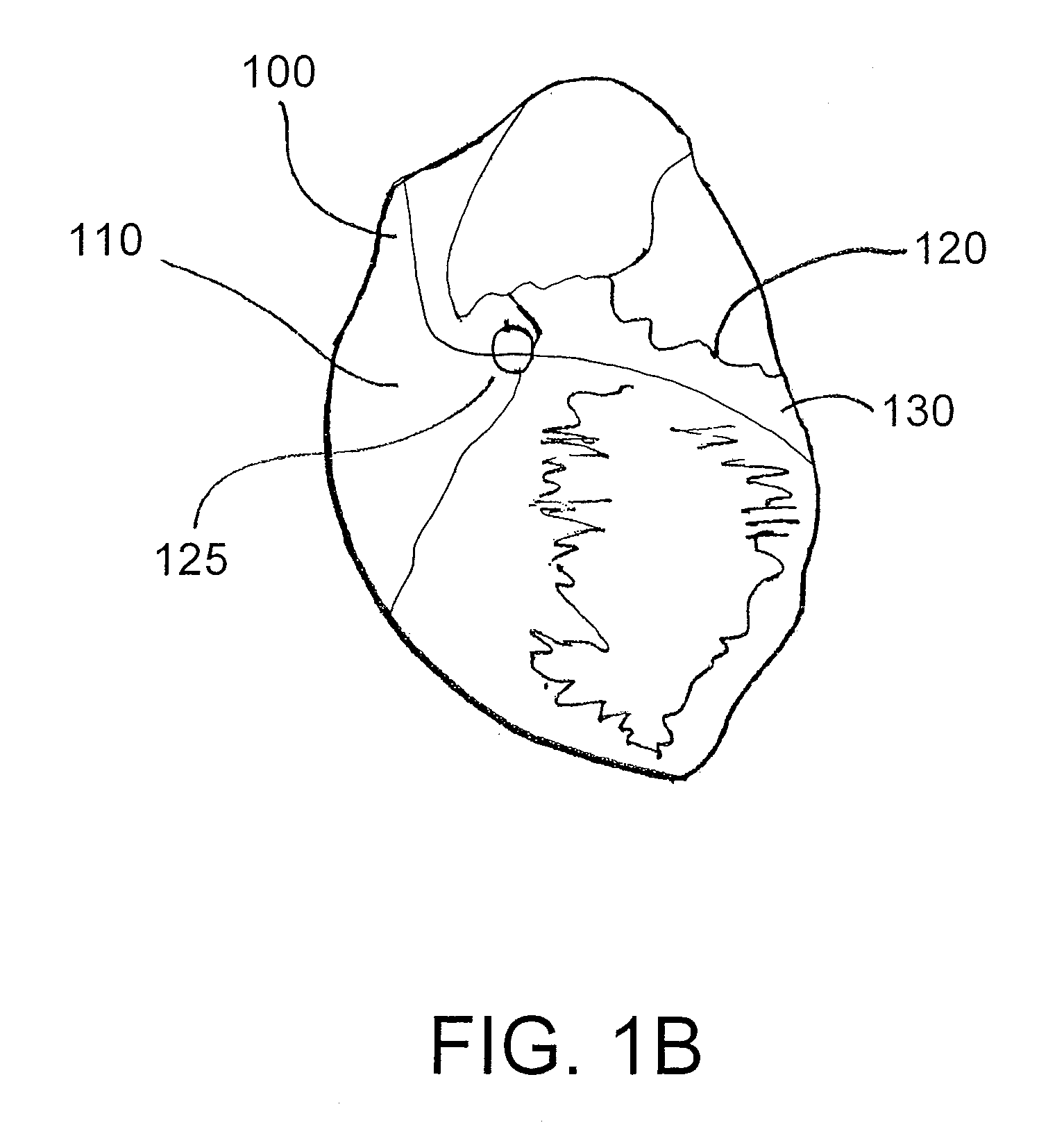 Devices for accessing the pericardial space surrounding the heart