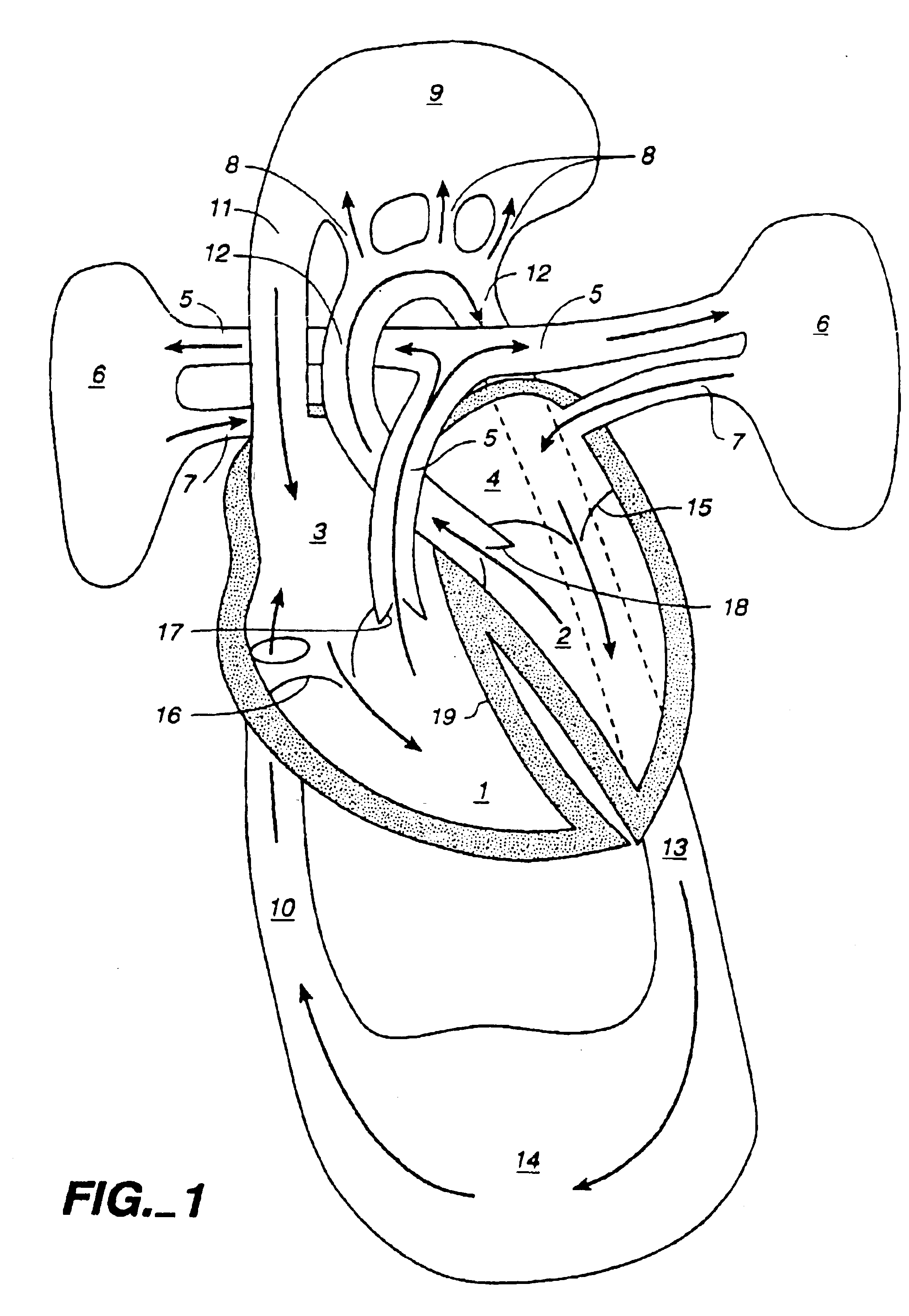 Multichannel catheter
