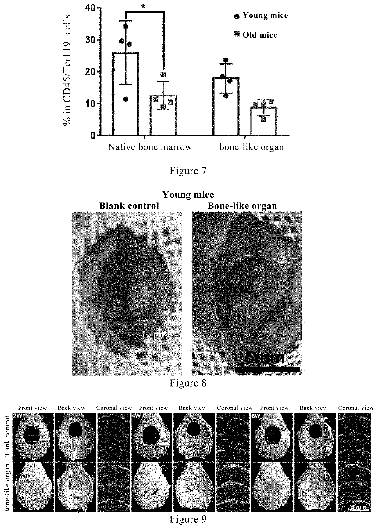 New use of stem cell generator in preparation of bone defect repair materials