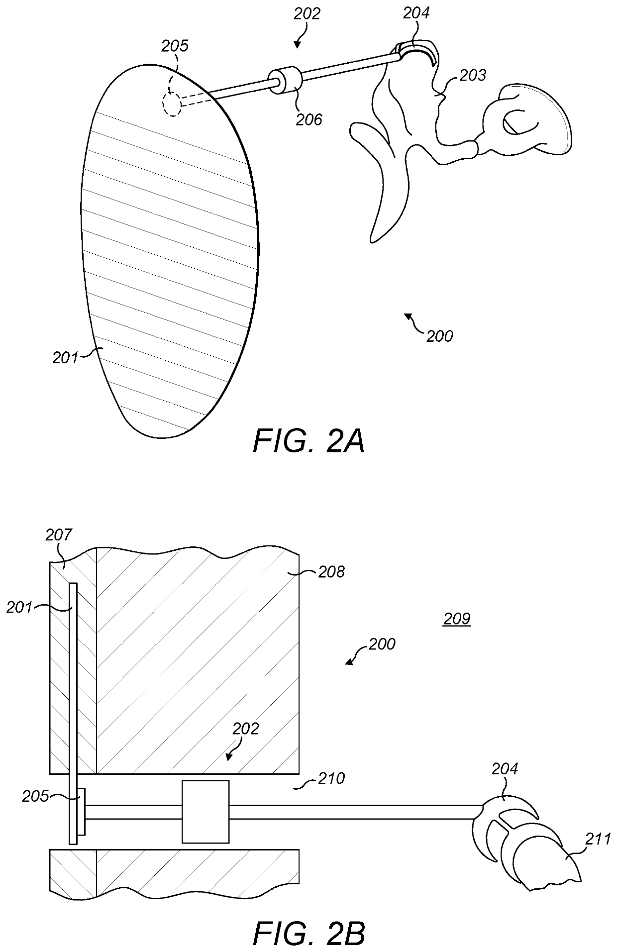 Passive Hearing Implant