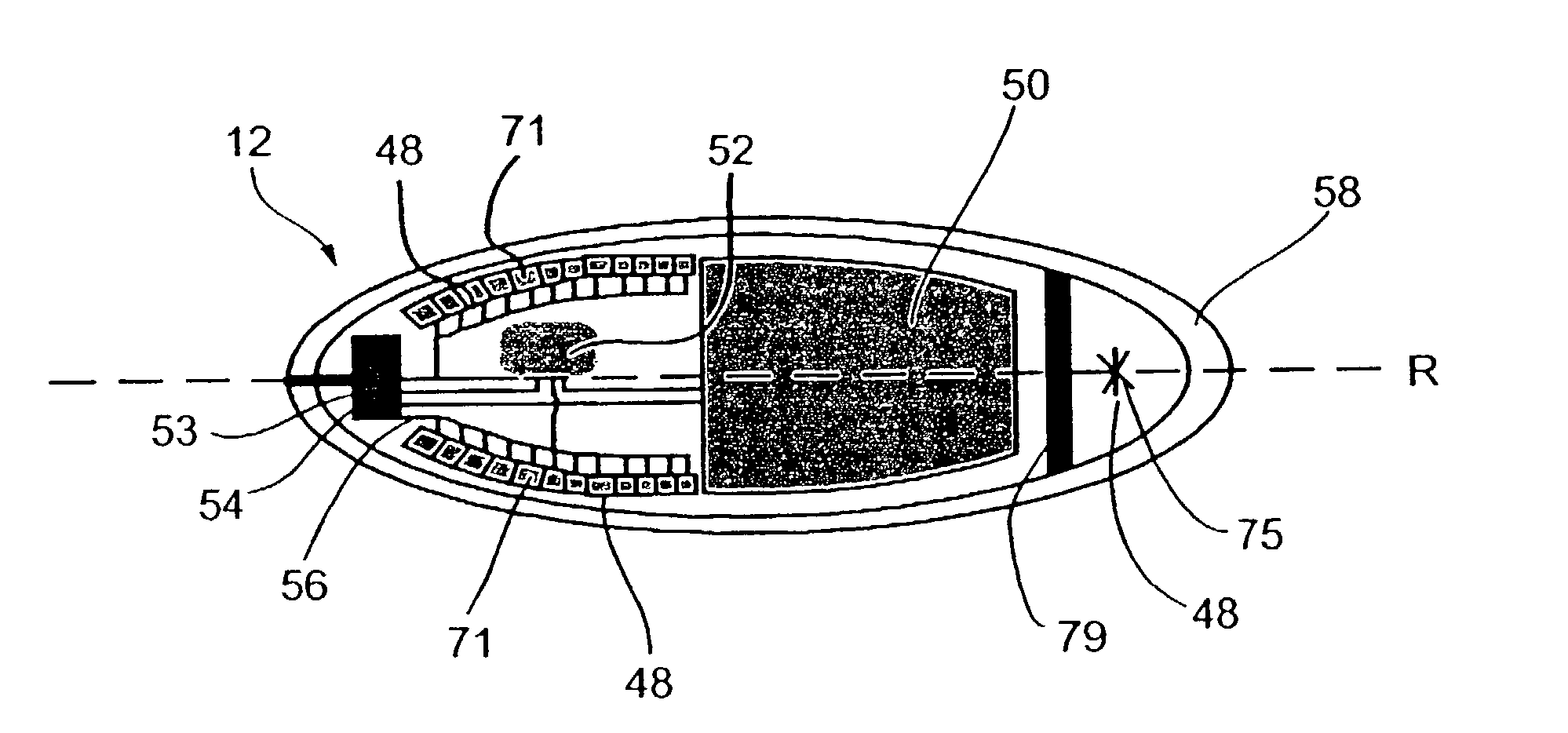 Ingestible device for radioimaging of the gastrointestinal tract