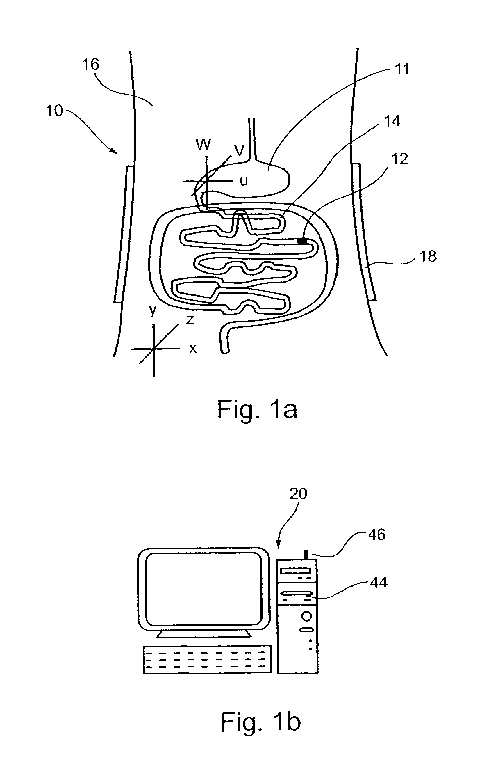 Ingestible device for radioimaging of the gastrointestinal tract