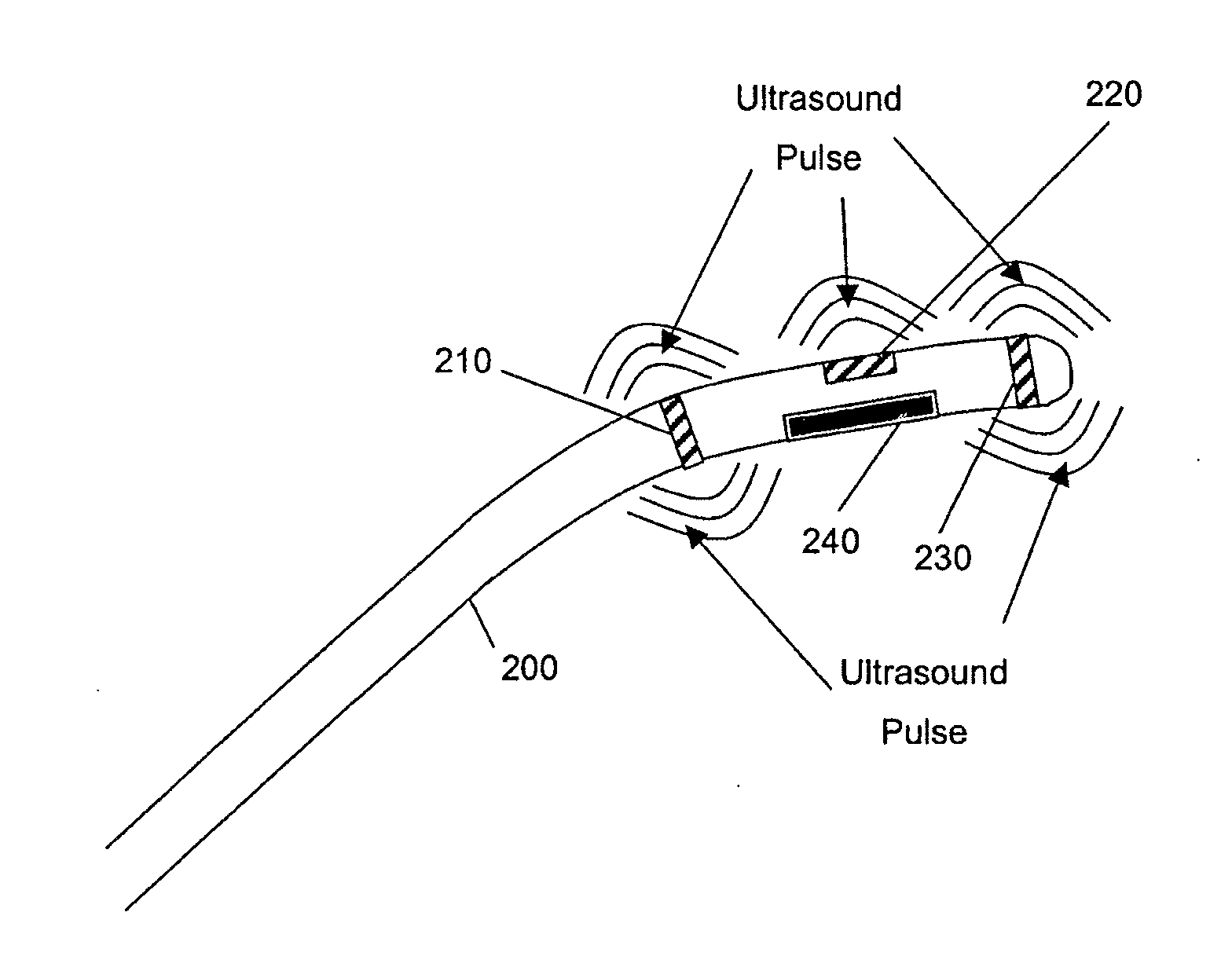 Method and apparatus for localizing an ultrasound catheter
