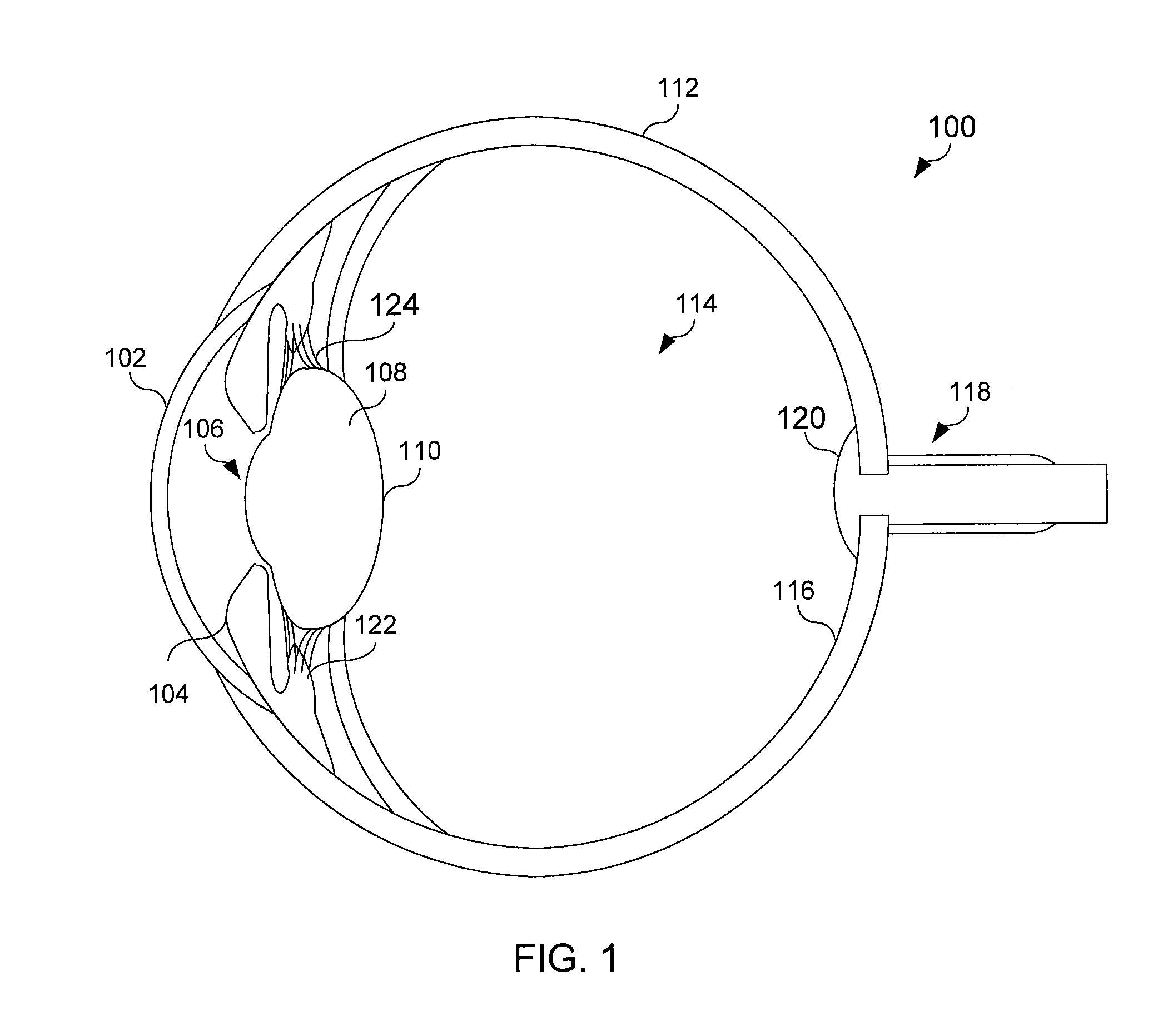 Ophthalmic endoillumination using fiber generated light