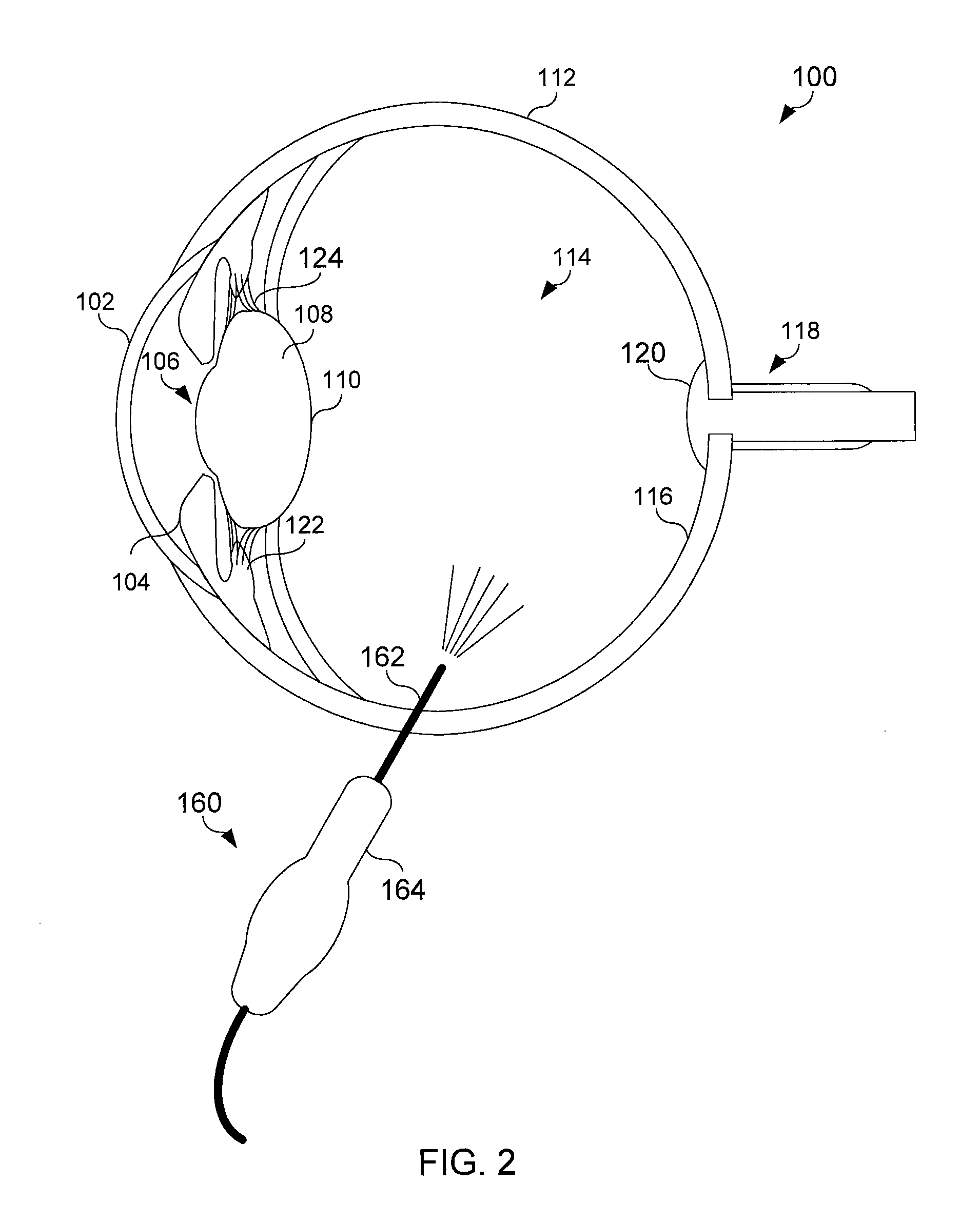 Ophthalmic endoillumination using fiber generated light