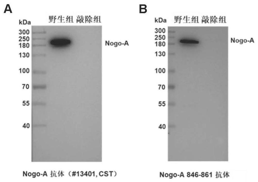 Small molecule peptide with analgesic effect and specific antibody thereof