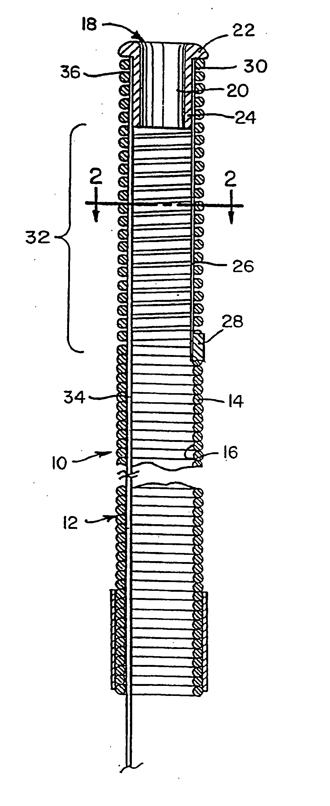 Irrigation and aspiration device