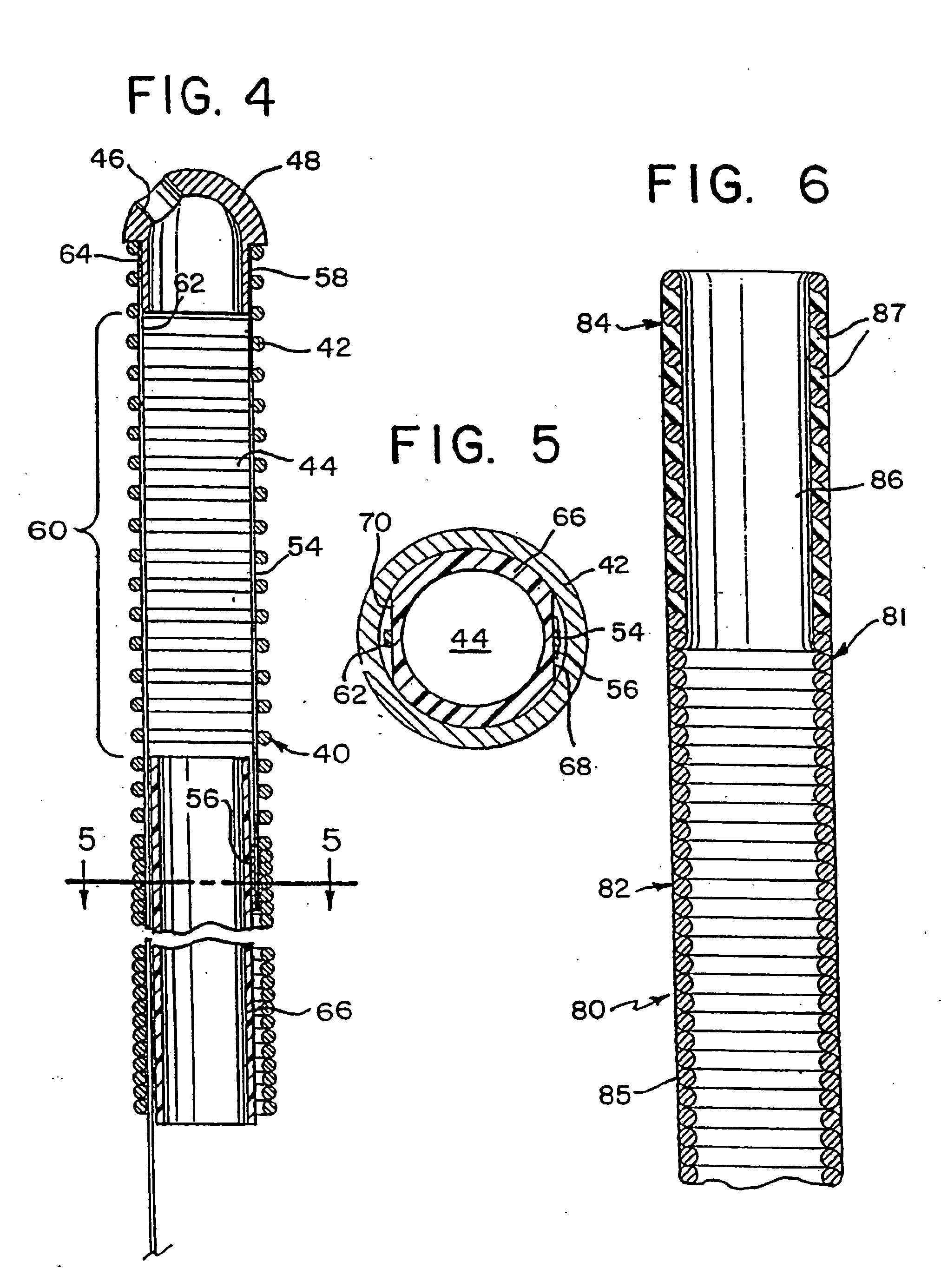 Irrigation and aspiration device