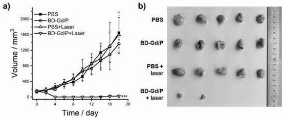 Preparation and application of boron dipyrromethene-gadolinium conjugate nano diagnosis and treatment reagent