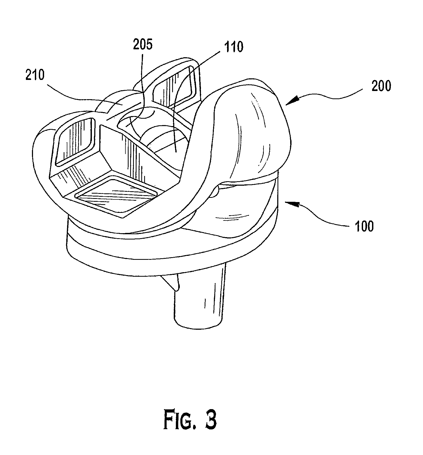 Knee prosthesis