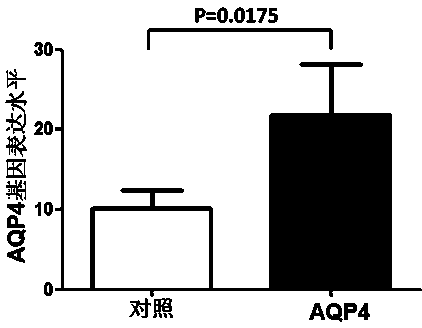 Detection method of aquaporin-4 autoantibody, fusion expression virus vector and application thereof